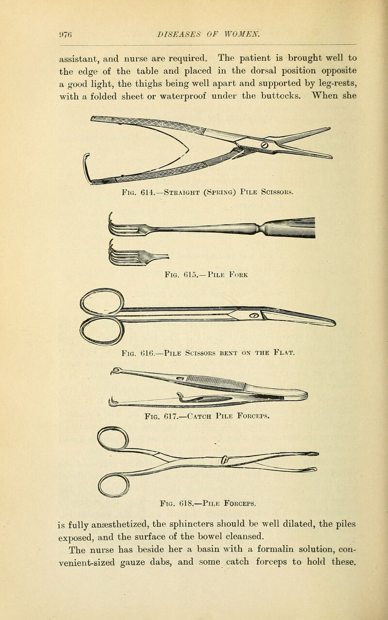 assistant, and nurse are required. The patient is brought well to the edge of the table and placed in the dorsal position opposite a good light, the thighs being well apart and supported by leg-rests, with a folded sheet or waterproof under the buttocks. When she Fi(i. 614.—Stkaight (Spring) Pile Scissors. Fig. 615.—Pile Fork Fig. 616.—Pile Scissors bent on the Flat. Fig. 618.—Pile Forceps. is fully anaesthetized, the sphincters should be well dilated, the piles exposed, and the surface of the bowel cleansed. The nurse has beside her a basin with a formalin solution, con- venient-sized gauze dabs, and some catch forceps to hold these.