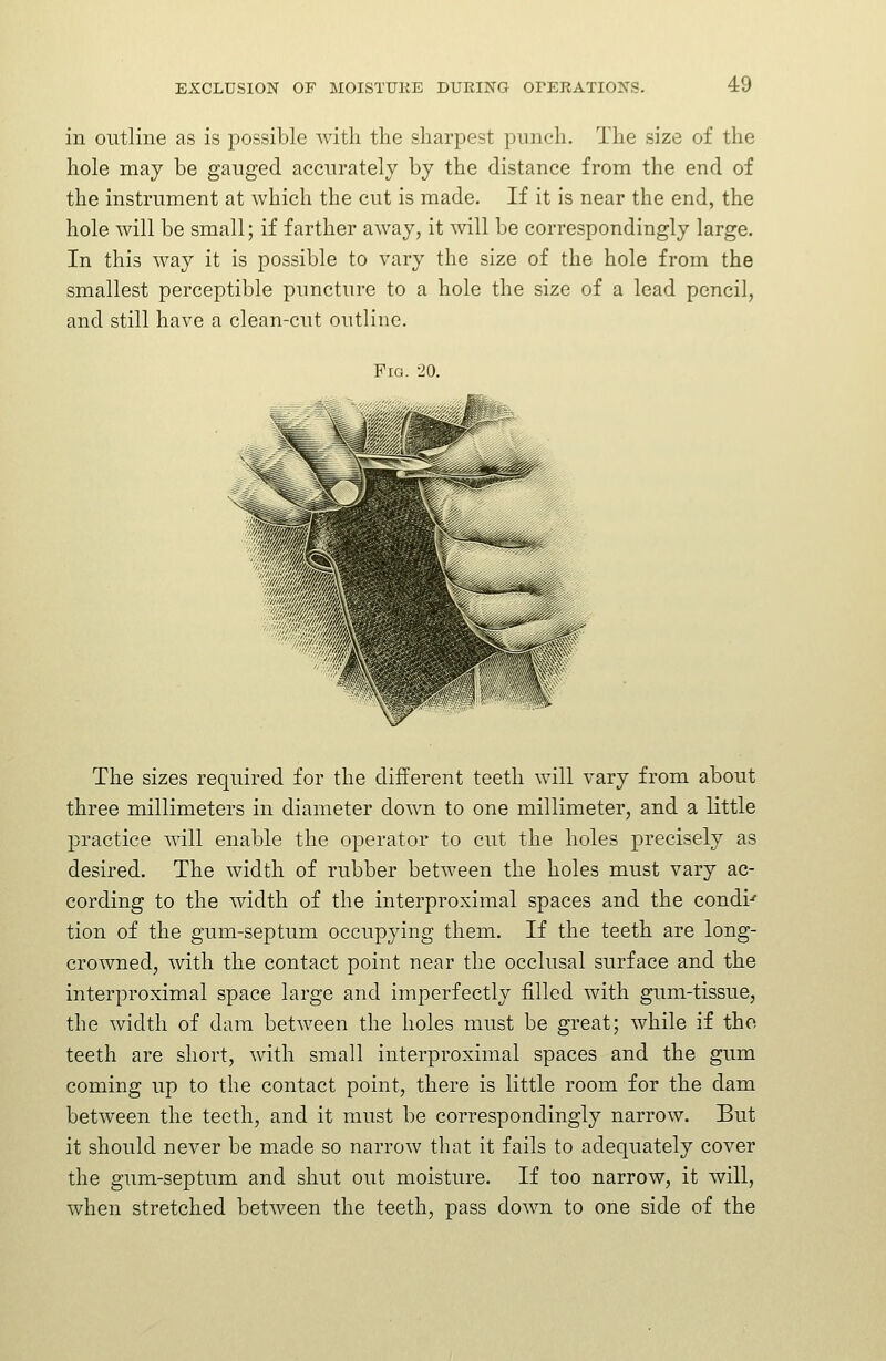 in outline as is possible with tlie sharpest punch. The size of the hole may be ganged accurately by the distance from the end of the instrument at which the cut is made. If it is near the end, the hole will be small; if farther away, it will be correspondingly large. In this way it is possible to vary the size of the hole from the smallest perceptible puncture to a hole the size of a lead pencil, and still have a clean-cut outline. The sizes required for the different teeth will vary from about three millimeters in diameter down to one millimeter, and a little 23ractice will enable the operator to cut the holes precisely as desired. The width of rubber between the holes must vary ac- cording to the width of the interproximal spaces and the condi' tion of the gum-septum occupying them. If the teeth are long- croAvned, with the contact point near the occlusal surface and the interproximal space large and imperfectly filled with gum-tissue, the width of dam between the holes must be great; while if the teeth are short, with small interproximal spaces and the gum coming up to the contact point, there is little room for the dam between the teeth, and it must be correspondingly narrow. But it should never be made so narrow that it fails to adequately cover the gum-septum and shut out moisture. If too narrow, it will, when stretched between the teeth, pass down to one side of the