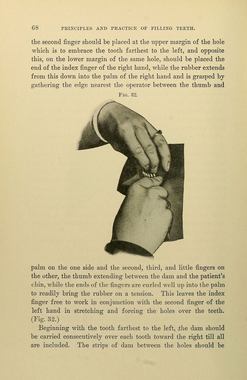 the second finger should be placed at the upper margin of the hole which is to embrace the tooth farthest to the left, and opposite this, on the lower margin of the same hole, should be placed the end of the index finger of the right hand, while the rubber extends from this down into the palm of the right hand and is grasped by gathering the edge nearest the operator between the thumb and Fio. 32. palm on the one side and the second, third, and little fingers on the other^, the thumb extending between the dam and the patient's chin, while the ends of the fingers are curled well up into the palm to readily bring the rubber on a tension. This leaves the index finger free to work in conjunction with the second finger of the left hand in stretching and forcing the holes over the teeth. (Fig. 32.) Beginning with the tooth farthest to the left, .the dam should be carried consecutively over each tooth toward the right till all are included. The strips of dam between the holes should be