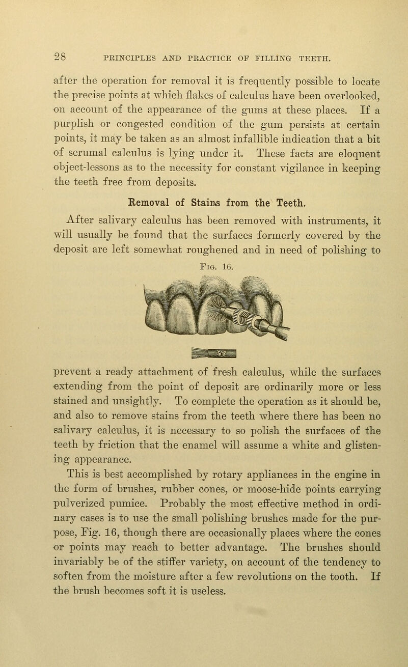 after the operation for removal it is frequently possible to locate the precise points at which flakes of calcnkis have been overlooked, on account of the appearance of the gums at these places. If a purplish or congested condition of the gum persists at certain points, it may be taken as an almost infallible indication that a bit of serumal calculus is lying under it. These facts are eloquent object-lessons as to the necessity for constant vigilance in keeping the teeth free from deposits. Removal of Stains from the Teeth. After salivary calculus has been removed with instruments, it will usually be found that the surfaces formerly covered by the deposit are left somewhat roughened and in need of polishing to Fig. 16. prevent a ready attachment of fresh calculus, while the surfaces ■extending from the point of deposit are ordinarily more or less stained and unsightly. To complete the operation as it should be, and also to remove stains from the teeth where there has been no salivary calculus, it is necessary to so polish the surfaces of the teeth by friction that the enamel will assume a white and glisten- ing appearance. This is best accomplished by rotary appliances in the engine in the form of brushes, rubber cones, or moose-hide points carrying pulverized pumice. Probably the most effective method in ordi- nary cases is to use the small polishing brushes made for the pur- pose, Fig. 16, though there are occasionally places where the cones or points may reach to better advantage. The brushes should invariably be of the stiffer variety, on account of the tendency to soften from the moisture after a few revolutions on the tooth. If the brush becomes soft it is useless.