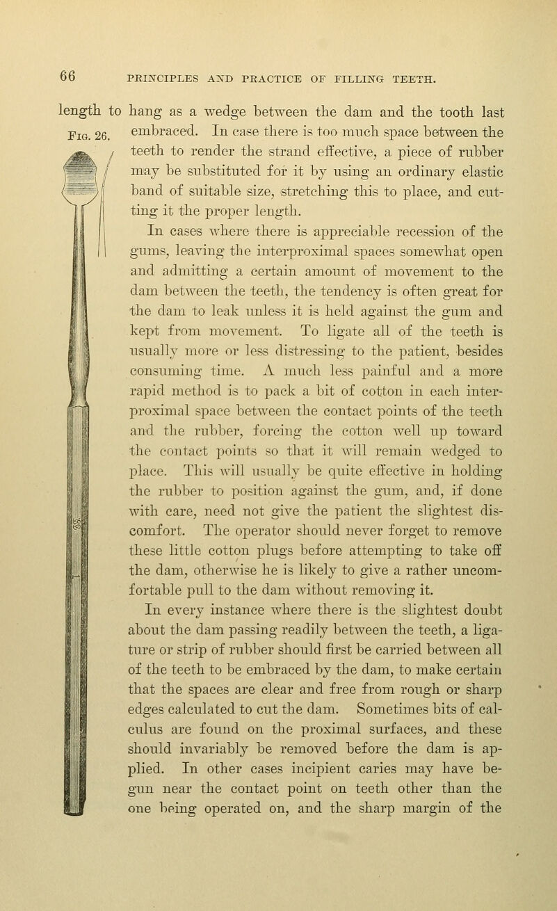 length to hang as a wedge between the dam and the tooth last Fig. 26. embraced. In case there is too much space between the teeth to render the strand effective, a piece of rnbber may be substituted for it by using an ordinary elastic band of suitable size, stretching this to place, and cut- ting it the proper length. In cases where there is appreciable recession of the gums, leaving the interproximal spaces somewhat open and admitting a certain amount of movement to the dam between the teeth, the tendency is often great for the dam to leak unless it is held against the gum and kept from movement. To ligate all of the teeth is usually more or less distressing to the patient, besides consuming time. A much less painful and a more rapid method is to pack a bit of cotton in each inter- proximal space between the contact points of the teeth and the rubber, forcing the cotton well up toward the contact points so that it will remain wedged to jDlace. This will usually be quite effective in holding the rubber to position against the gum, and, if done with care, need not give the patient the slightest dis- comfort. The operator should never forget to remove these little cotton plugs before attempting to take off the dam, otherwise he is likely to give a rather uncom- fortable pull to the dam without removing it. In every instance where there is the slightest doubt about the dam passing readily between the teeth, a liga- ture or strip of rubber should first be carried between all of the teeth to be embraced by the dam, to make certain that the spaces are clear and free from rough or sharp edges calculated to cut the dam. Sometimes bits of cal- culus are found on the proximal surfaces, and these should invariably be removed before the dam is ap- plied. In other cases incipient caries may have be- gun near the contact point on teeth other than the one being operated on, and the sharp margin of the