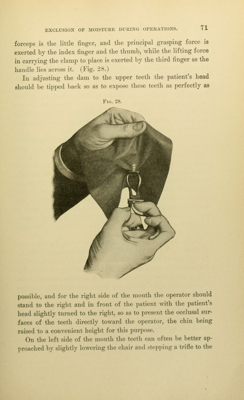 forceps is the little finger, and the principal grasping force is exerted by the index finger and the thumb, while the lifting force in carrying the clamp to place is exerted by the third finger as the handle lies across it. (Fig. 28.) In adjusting the dam to the upper teeth the patient's head should be tipped back so as to expose these teeth as perfectly as Fig. 28. possible, and for the right side of the mouth the operator should stand to the right and in front of the patient with the patient's head slightly turned to the right, so as to present the occlusal sur- faces of the teeth directly toward the operator, the chin being raised to a convenient height for this purpose. On the left side of the mouth the teeth can often be better ap- proached by slightly lowering the chair and stepping a trifle to the