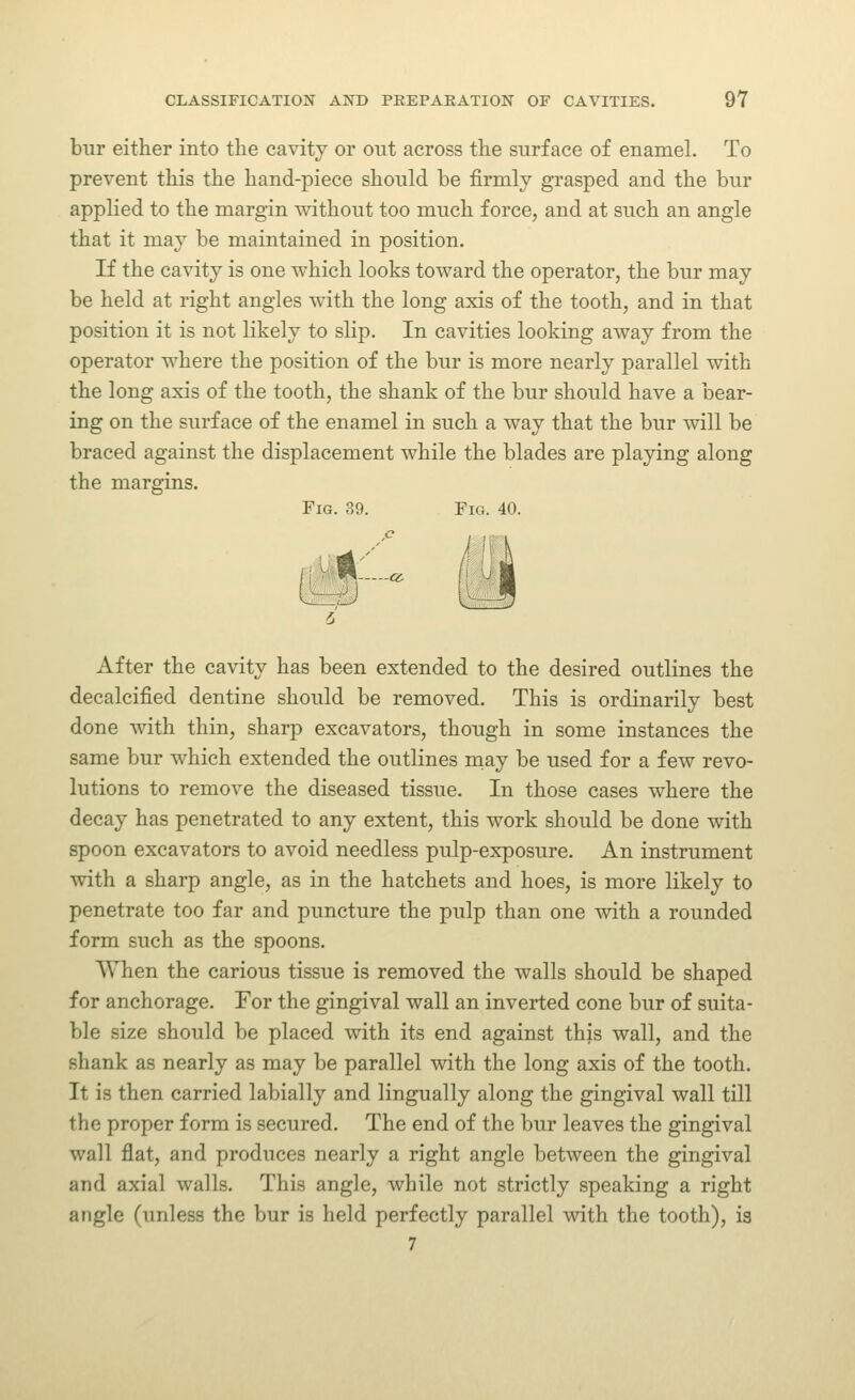 bur either into the cavity or out across the surface of enamel. To prevent this the hand-piece should be firmly grasped and the bur applied to the margin mthout too much force, and at such an angle that it may be maintained in position. If the cavity is one which looks toward the operator, the bur may be held at right angles with the long axis of the tooth, and in that position it is not likely to slip. In cavities looking away from the operator where the position of the bur is more nearly parallel with the long axis of the tooth, the shank of the bur should have a bear- ing on the surface of the enamel in such a way that the bur will be braced against the displacement while the blades are playing along the margins. Fig. 39. Fig. 40. feti' After the cavity has been extended to the desired outlines the decalcified dentine should be removed. This is ordinarily best done with thin, sharp excavators, though in some instances the same bur which extended the outlines may be used for a few revo- lutions to remove the diseased tissue. In those cases Avhere the decay has penetrated to any extent, this work should be done with spoon excavators to avoid needless pulp-exposure. An instrument with a sharp angle, as in the hatchets and hoes, is more likely to penetrate too far and puncture the pulp than one with a rounded form such as the spoons. When the carious tissue is removed the walls should be shaped for anchorage. For the gingival wall an inverted cone bur of suita- ble size should be placed with its end against this wall, and the shank as nearly as may be parallel with the long axis of the tooth. It is then carried labially and lingually along the gingival wall till the proper form is secured. The end of the bur leaves the gingival wall flat, and produces nearly a right angle between the gingival and axial walls. This angle, while not strictly speaking a right angle (unless the bur is held perfectly parallel with the tooth), is 7