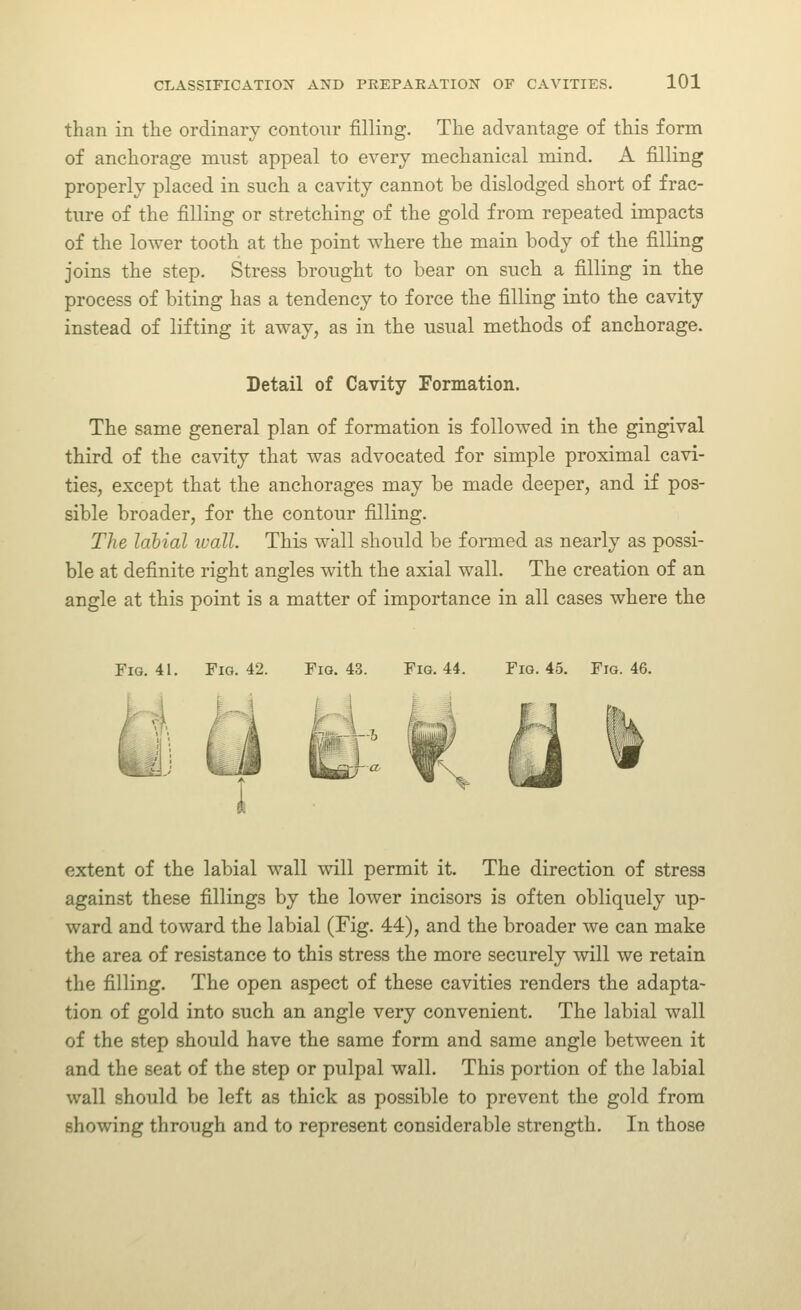 than in the ordinary contour filling. The advantage of this form of anchorage mnst appeal to every mechanical mind. A filling properly placed in such a cavity cannot be dislodged short of frac- ture of the filling or stretching of the gold from repeated impacts of the lower tooth at the point where the main body of the filling joins the step. Stress brought to bear on such a filling in the process of biting has a tendency to force the filling into the cavity instead of lifting it away, as in the usual methods of anchorage. Detail of Cavity Formation. The same general plan of formation is followed in the gingival third of the cavity that was advocated for simple proximal cavi- ties, except that the anchorages may be made deeper, and if pos- sible broader, for the contour filling. The labial wall. This wall should be fonned as nearly as possi- ble at definite right angles with the axial wall. The creation of an angle at this point is a matter of importance in all cases where the Fig. 41. Fig. 42. Fig. 43. Fig. 44. Fig. 45. Fig. 46. extent of the labial wall will permit it. The direction of stress against these fillings by the lower incisors is often obliquely up- ward and toward the labial (Fig. 44), and the broader we can make the area of resistance to this stress the more securely will we retain the filling. The open aspect of these cavities renders the adapta- tion of gold into such an angle very convenient. The labial wall of the step should have the same form and same angle between it and the seat of the step or pulpal wall. This portion of the labial wall should be left as thick as possible to prevent the gold from showing through and to represent considerable strength. In those