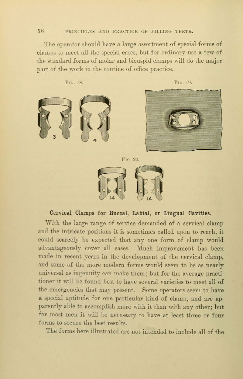 The operator slioiild have a large assortment of special forms of clamps to m.eet all the special cases, but for ordinary use a few of the standard forms of molar and bicuspid clamps will do the major part of the work in the routine of office practice. Fig. 18. Fig. 19. Fig 20. Cervical Clamps for Buccal, Labial, or Ling-ual Cavities. With the large range of service demanded of a cervical clamp and the intricate positions it is sometimes called upon to reach, it could scarcely be expected that any one form of clamp would advantageously cover all cases. Much improvement has been made in recent years in the development of the cervical clamp, and .some of the more modem forms would seem to be as nearly universal as ingenuity can make them; but for the average practi- tioner it will be found best to have several varieties to meet all of the emergencies that may present. Some operators seem to have a special aptitude for one particular kind of clamp, and are ap- parently able to accomplish more with it than with any other; but for mo.st men it will be necessary to have at least three or four forms to secure the best results. The forms here illustrated are not intended to include all of the