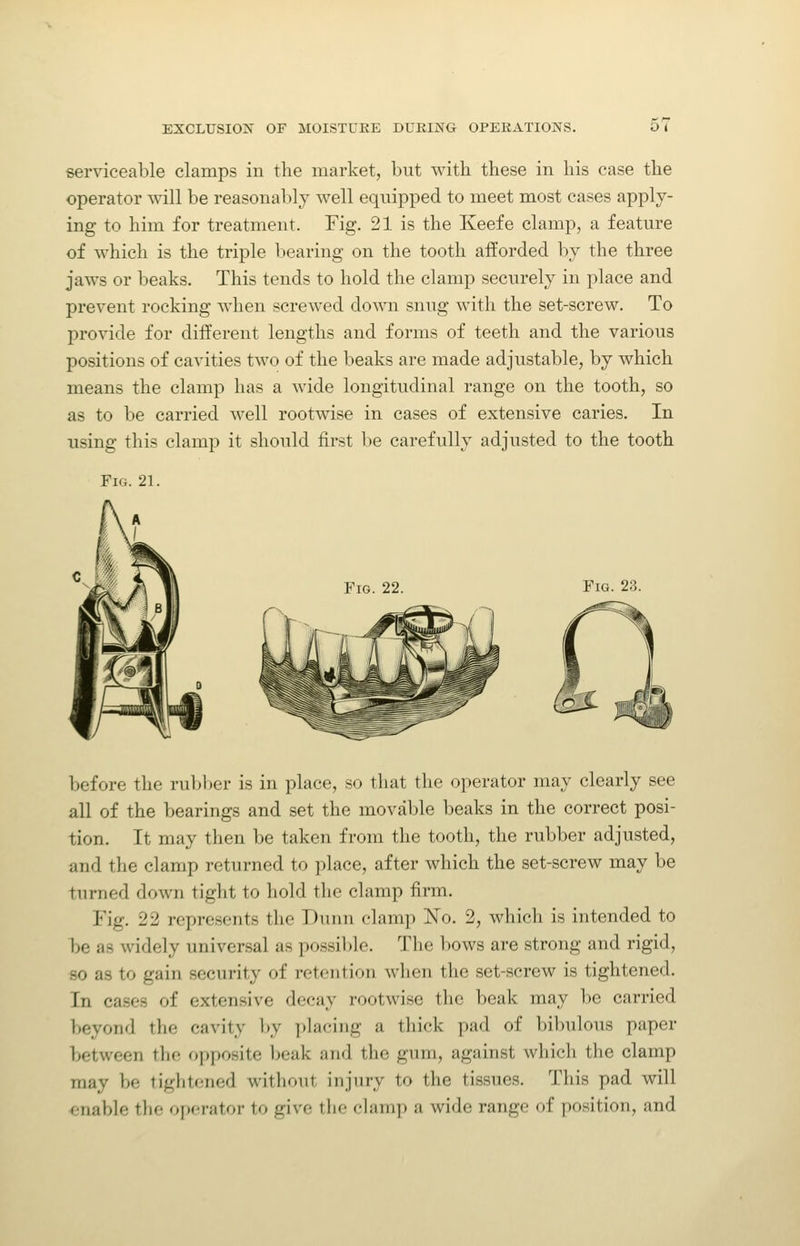 serviceable clamps in the market, but with these in his case the operator will be reasonably well equipped to meet most cases apply- ing to him for treatment. Fig. 21 is the Keefe clamp, a feature of which is the triple bearing on the tooth afforded by the three jaws or beaks. This tends to hold the clamp securely in place and prevent rocking when screwed down snug with the set-screw. To provide for different lengths and forms of teeth and the various positions of cavities two of the beaks are made adjustable, by which means the clamp has a wide longitudinal range on the tooth, so as to be carried well rootwise in cases of extensive caries. In using this clamp it should first be carefully adjusted to the tooth Fig. 21. Fig. 22. Fig. 23. before the rultber is in place, so that the operator may clearly see all of the bearings and set the movable beaks in the correct posi- tion. It may then be taken from the tooth, the rubber adjusted, and the clamp retnrned to place, after which the set-screw may be turned down tight to hold the clamp firm. Fig. 22 represents the Dunn clamp jSTo. 2, whicli is intended to be as widely universal as po.ssible. The bows are strong and rigid, so as to gain security of retention when the set-screw is tightened. In cases of extensive decay rootwise the beak may be carried beyond the cavity by ])lacing a tliick pad of bibulous paper between the opposite l^eak and tlie gum, against which the clamp may be tightened without injury to the tissues. This pad will enable the operator to give the clamp a wide range of position, and