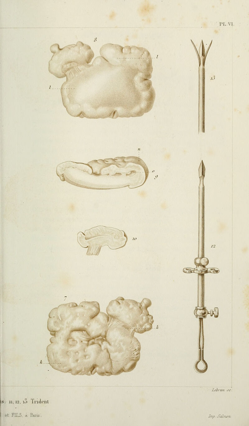 M.,VI, Vi /^ i ' 7, S. u, w, 1.) Tridoiil et FE-S, a Paris. Imf>. SaJ.-nûn