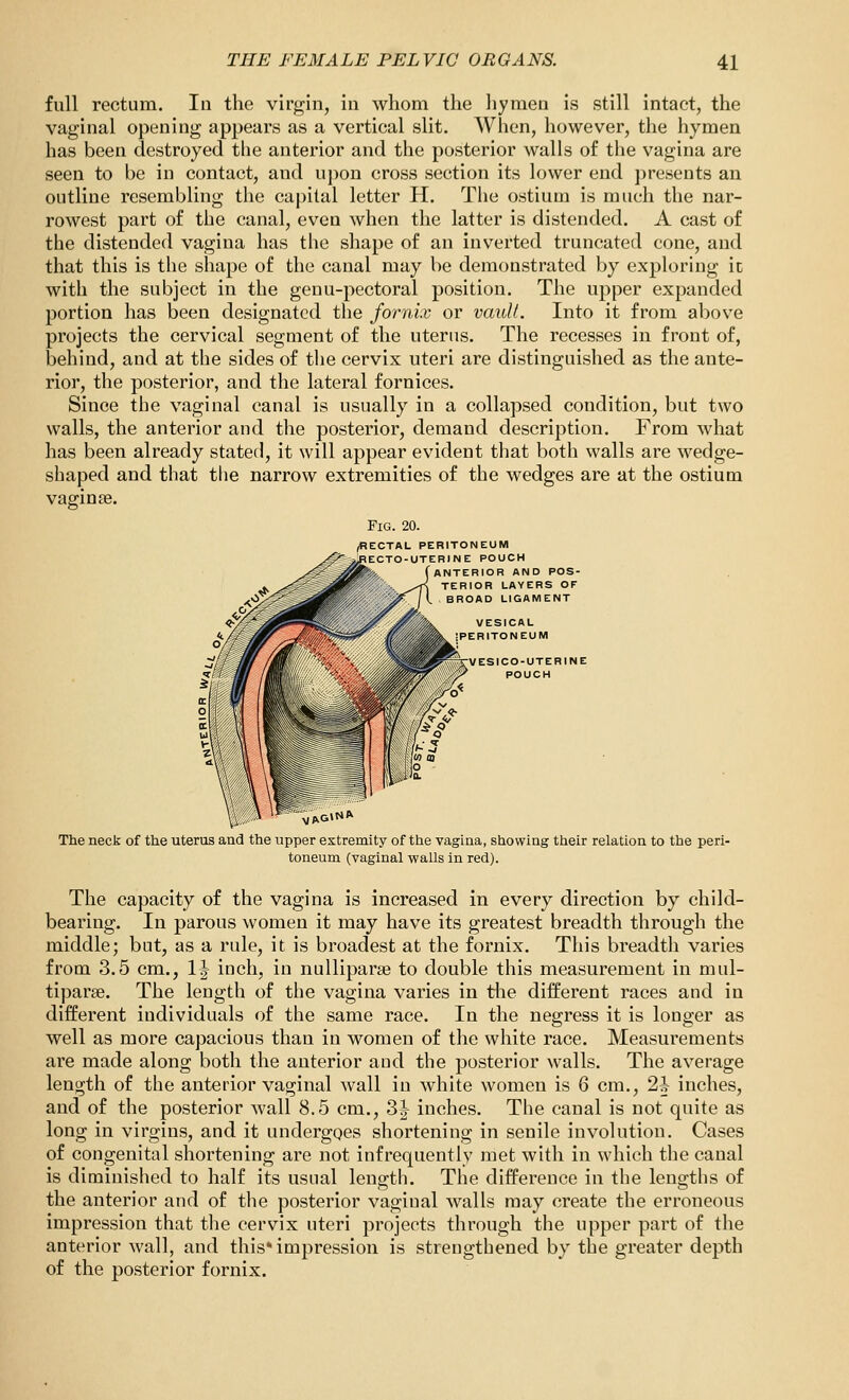 full rectum. In the virgin, in whom the hymen is still intact, the vaginal opening appears as a vertical slit. When, however, the hymen has been destroyed the anterior and the posterior walls of the vagina are seen to be in contact, and upon cross section its lower end presents an outline resembling the capital letter H. The ostium is much the nar- rowest part of the canal, even when the latter is distended. A cast of the distended vagina has the shape of an inverted truncated cone, and that this is the shape of the canal may be demonstrated by exploring ic with the subject in the genu-pectoral position. The upper expanded portion has been designated the fornix or vauU. Into it from above projects the cervical segment of the uterus. The recesses in front of, behind, and at the sides of the cervix uteri are distinguished as the ante- rior, the posterior, and the lateral fornices. Since the vaginal canal is usually in a collapsed condition, but two walls, the anterior and the posterior, demand description. From what has been already stated, it will appear evident that both walls are wedge- shaped and that the narrow extremities of the wedges are at the ostium vaginae. Fig. 20. rectal peritoneum E POUCH ERIOR AND POS- 1IOR LAYERS OF OAD LIGAMENT VESICAL ERITONEUM VESICO-UTERINE POUCH The neck of the uterus and the upper extremity of the vagina, showing their relation to the peri- toneum (vaginal walls in red). The capacity of the vagina is increased in every direction by child- bearing. In parous women it may have its greatest breadth through the middle; but, as a rule, it is broadest at the fornix. This breadth varies from 3.5 cm., 1^ inch, in nullipara? to double this measurement in mul- tiparge. The length of the vagina varies in tlie different races and in different individuals of the same race. In the negress it is longer as well as more capacious than in women of the white race. Measurements are made along both the anterior and the posterior walls. The average length of the anterior vaginal wall in white women is 6 cm., 2h inches, and of the posterior wall 8.5 cm., 3|- inches. The canal is not quite as long in virgins, and it undergoes shortening in senile involution. Cases of congenital shortening are not infrequently met with in which the canal is diminished to half its usual leno;th. The difference in the lengths of the anterior and of the posterior vaginal walls may create the erroneous impression that the cervix uteri projects through the upper part of the anterior wall, and this* impression is strengthened by the greater depth of the posterior fornix.