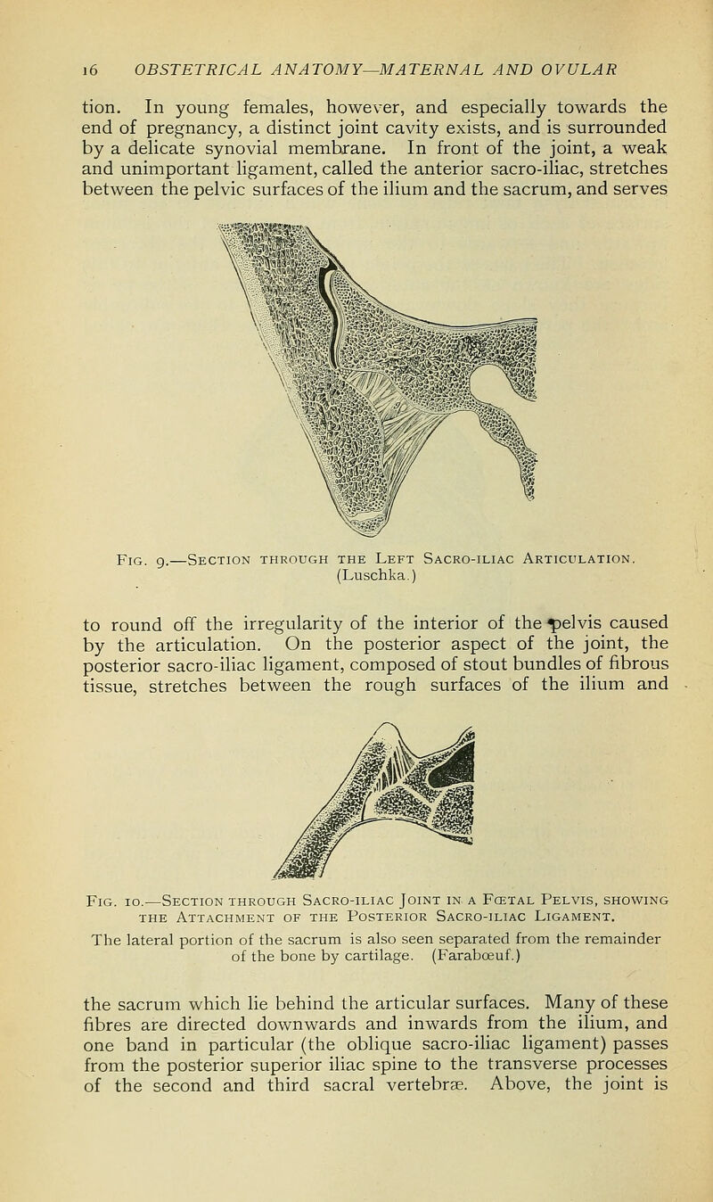 tion. In young females, however, and especially towards the end of pregnancy, a distinct joint cavity exists, and is surrounded by a delicate synovial membrane. In front of the joint, a weak and unimportant ligament, called the anterior sacro-iliac, stretches between the pelvic surfaces of the ilium and the sacrum, and serves Fig. 9.—Section through the Left Sacro-iliac Articulation. (Luschka.) to round off the irregularity of the interior of the pelvis caused by the articulation. On the posterior aspect of the joint, the posterior sacro-iliac ligament, composed of stout bundles of fibrous tissue, stretches between the rough surfaces of the ilium and Fig. io.—Section through Sacro-iliac Joint in a Fcetal Pelvis, showing the Attachment of the Posterior Sacro-iliac Ligament. The lateral portion of the sacrum is also seen separated from the remainder of the bone by cartilage. (Farabceuf.) the sacrum which lie behind the articular surfaces. Many of these fibres are directed downwards and inwards from the ilium, and one band in particular (the oblique sacro-iliac ligament) passes from the posterior superior iliac spine to the transverse processes of the second and third sacral vertebrae. Above, the joint is