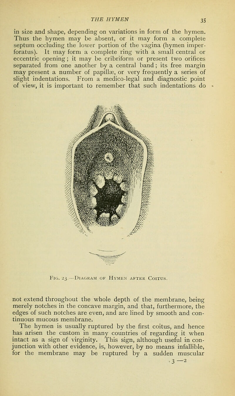 THE HYMEN in size and shape, depending on variations in form of the hymen. Thus the hymen may be absent, or it may form a complete septum occluding the lower portion of the vagina (hymen imper- foratus). It may form a complete ring with a small central or eccentric opening ; it may be cribriform or present two orifices separated from one another by a central band ; its free margin may present a number of papillae, or very frequently a series of slight indentations. From a medico-legal and diagnostic point of view, it is important to remember that such indentations do Fig. 23.—Diagram of Hymen after Coitus. not extend throughout the whole depth of the membrane, being merely notches in the concave margin, and that, furthermore, the edges of such notches are even, and are lined by smooth and con- tinuous mucous membrane. The hymen is usually ruptured by the first coitus, and hence has arisen the custom in many countries of regarding it when intact as a sign of virginity. This sign, although useful in con- junction with other evidence, is, however, by no means infallible, for the membrane may be ruptured by a sudden muscular 3—2