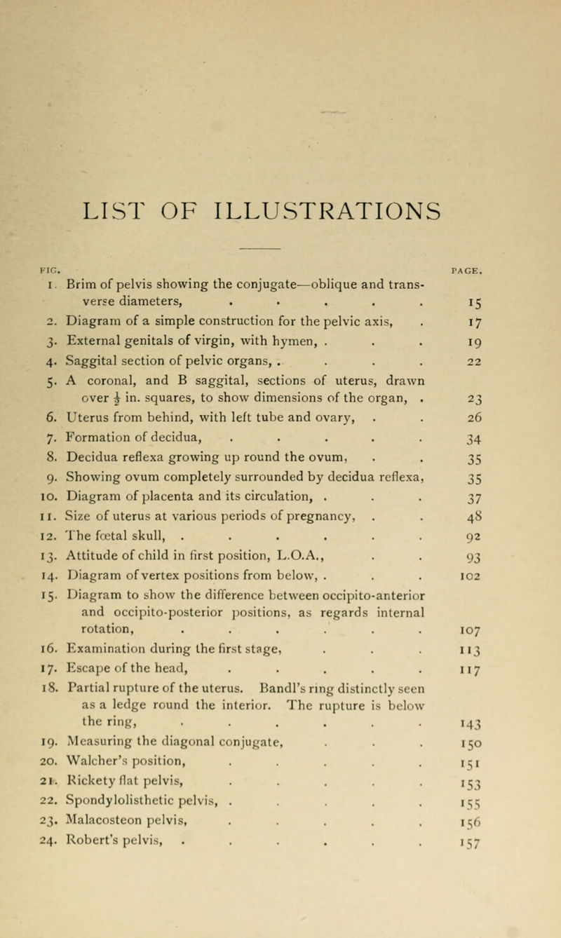 LIST OF ILLUSTRATIONS Fin. I. 4- 5- 6. 7- 8. 9- 10. II. 12. 13- 14. 15- 16. 17- 18. 19. 20. 21. 22. 23- 24. reflexa Brim of pelvis showing the conjugate—oblique and trans verse diameters, .... Diagram of a simple construction for the pelvic axis, External genitals of virgin, with hymen, . Saggital section of pelvic organs, . A coronal, and B saggital, sections of uterus, drawn over ^ in. squares, to show dimensions of the organ, Uterus from behind, with left tube and ovary. Formation of decidua, Decidua reflexa growing up round the ovum, Showing ovum completely surrounded by decidua Diagram of jjlacenta and its circulation, . Size of uterus at various periods of pregnancy, The foetal skull, .... Attitude of child in first position, L.O.A., Diagram of vertex positions from below, . Diagram to show the difference between occipito and occipito-posterior jiositions, as regards rotation, .... Examination during the first stage, Escape of the head. Partial rupture of the uterus. Bandl's rmg distinctly seen as a ledge round the interior. The rupture the ring. Measuring the diagonal conjugate, Walcher's position. Rickety flat pelvis. Spondylolisthetic pelvis, . Malacosteon pelvis, Robert's pelvis. anterior internal s below 15 17 19 22 26 34 35 35 37 48 92 93 102 107 3 117 143 150 151 '53 153 156 «57