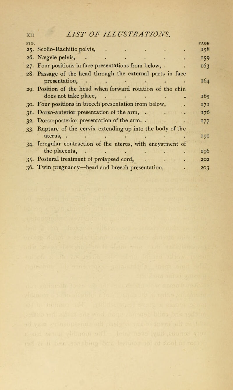 FIG. 25. Scolio-Rachitic pelvis, .... 26. Nsegele pelvis, ..... 27. Four positions in face presentations from below, . 28. Passage of the head through the external parts in face presentation, ..... 29. Position of the head when forward rotation of the chin does not take place, .... 30. Four positions in breech presentation from below, 31. Dorso-anterior presentation of the arm, . 32. Dorso-posterior presentation of the arm, . 33. Rupture of the cervix extending up into the body of the uterus, ...... 34. Irregular contraction of the uterus, with encystment of the placenta, ..... 35. Postural treatment of prolapsed cord, 36. Twin pregnancy—head and breech presentation, PAGE 159 163 164 165 171 176 177 191 196 202 203