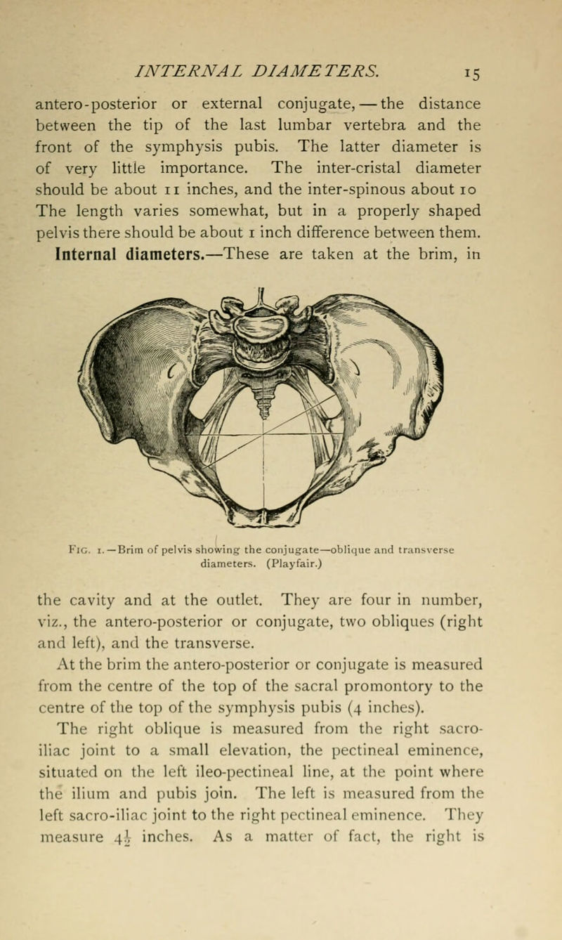 antero-posterior or external conjugate, — the distance between the tip of the last lumbar vertebra and the front of the symphysis pubis. The latter diameter is of very little importance. The inter-cristal diameter should be about ii inches, and the inter-spinous about 10 The length varies somewhat, but in a properly shaped pelvis there should be about i inch difference between them. Internal diameters.—These are taken at the brim, in Fig. I. —Brim of pelvis showing the conjugate—oblique and transverse diameters. (Playfair.) the cavity and at the outlet. They are four in number, viz., the antero-posterior or conjugate, two obliques (right and left), and the transverse. At the brim the antero-posterior or conjugate is measured from the centre of the top of the sacral promontory to the centre of the top of the symphysis pubis (4 inches). The right oblique is measured from the right sacro- iliac joint to a small elevation, the pectineal eminence, situated on the left ileo-pectineal line, at the point where the ilium and pubis join. The left is measured from the left sacro-iliac joint to the right pectineal eminence. They measure 4^ inches. As a matter of fact, the right is