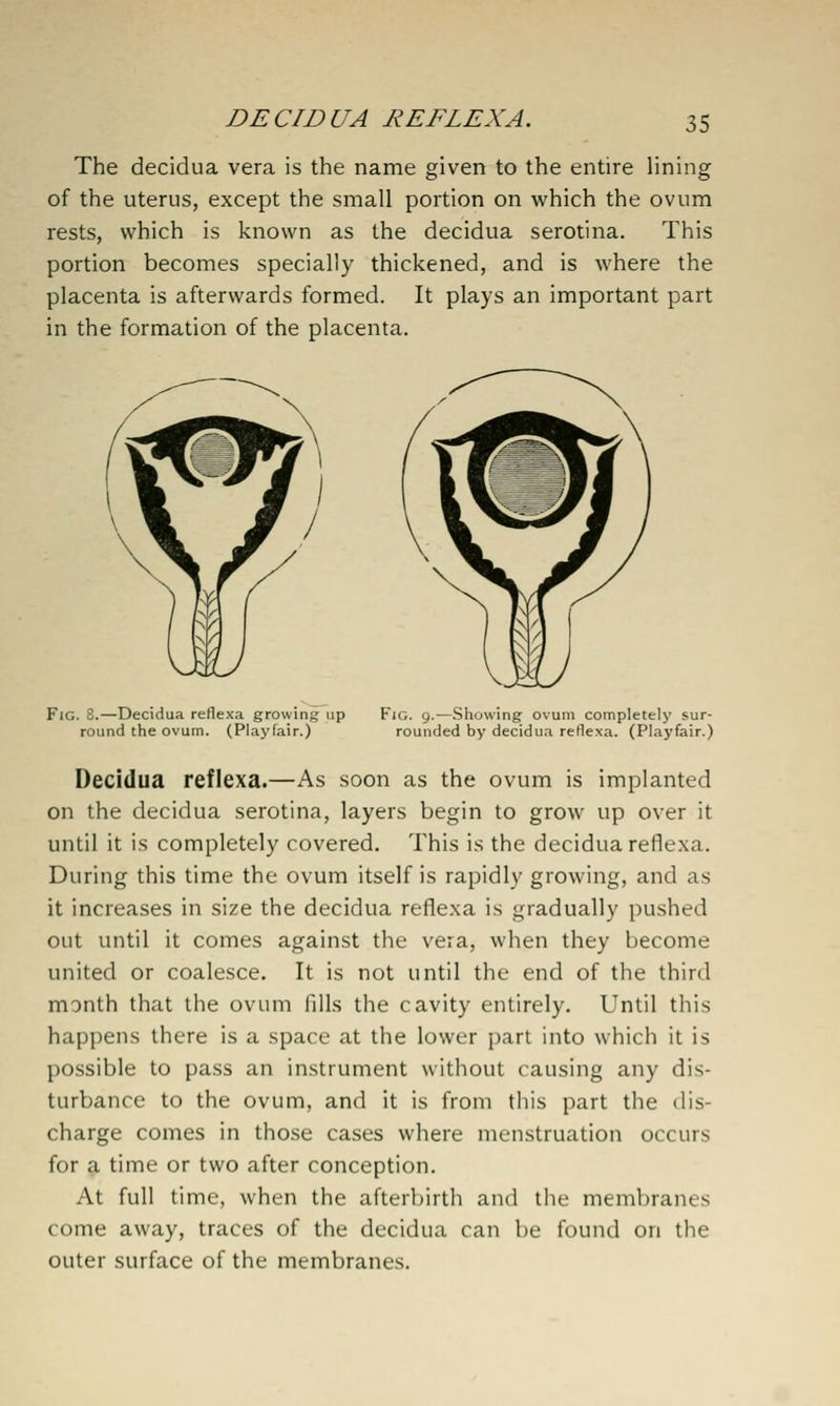 The decidua vera is the name given to the entire lining of the uterus, except the small portion on which the ovum rests, which is known as the decidua serotina. This portion becomes specially thickened, and is where the placenta is afterwards formed. It plays an important part in the formation of the placenta. Fig. 8.—Decidua reflexa growing up round the ovum. (Playfair.) Fig. 9.—Showing ovum completely sur- rounded by decidua reflexa. (Playfair.) Decidua reflexa.—As soon as the ovum is implanted on the decidua serotina, layers begin to grow up over it until it is completely covered. This is the decidua reflexa. During this time the ovum itself is rapidly growing, and as it increases in size the decidua reflexa is gradually pushed out until it comes against the vera, when they become united or coalesce. It is not until the end of the third month that the ovum fills the cavity entirely. Until this happens there is a space at the lower part into which it is possible to pass an instrument without causing any dis- turbance to the ovum, and it is from this part the dis- charge comes in those cases where menstruation occurs for a time or two after conception. At full time, when the afterbirth and the membranes come away, traces of the decidua can be found on the outer surface of the membranes.
