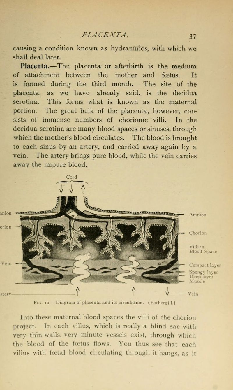 PLACENTA. causing a condition known as hydramnios, with which we shall deal later. Placenta.—The placenta or afterbirth is the medium of attachment between the mother and fcetus. It is formed during the third month. The site of the placenta, as we have already said, is the decidua serotina. This forms what is known as the maternal portion. The great bulk of the placenta, however, con- sists of immense numbers of chorionic villi. In the decidua serotina are many blood spaces or sinuses, through which the mother's blood circulates. The blood is brought to each sinus by an artery, and carried away again by a vein. The artery brings pure blood, while the vein carries away the impure blood. Cord V V Vein rlery Ki<;. lo.—Diagr.im of placenta and iis circulation. (Fothergill.) Into these maternal blood spaces the villi of the chorion project. In each villus, which is really a blind sac with very thin walls, very minute vessels exist, through which the blood of the fcttus flows. Vou thus see that each villus with fcetal blood circulating through it hangs, as it