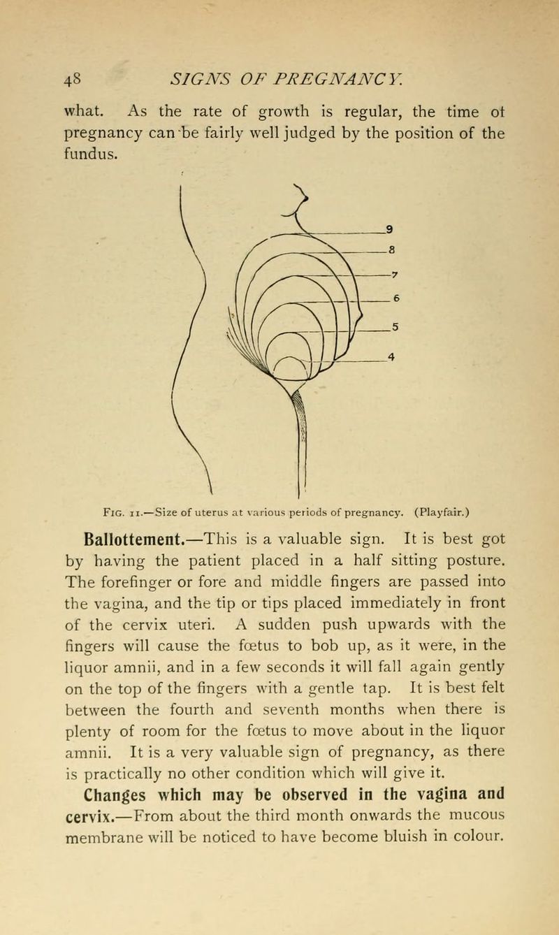 what. As the rate of growth is regular, the time ot pregnancy can be fairly well judged by the position of the fundus. Fig. II.—Size of uterus at various periods of pregnancy. (Playfair.) Ballottement.—This is a valuable sign. It is best got by having the patient placed in a half sitting posture. The forefinger or fore and middle fingers are passed into the vagina, and the tip or tips placed immediately in front of the cervix uteri. A sudden push upwards with the fingers will cause the foetus to bob up, as it were, in the liquor amnii, and in a few seconds it will fall again gently on the top of the fingers with a gentle tap. It is best felt between the fourth and seventh months when there is plenty of room for the foetus to move about in the liquor amnii. It is a very valuable sign of pregnancy, as there is practically no other condition which will give it. Changes which may be observed in the vagina and cervix.—From about the third month onwards the mucous membrane will be noticed to have become bluish in colour.