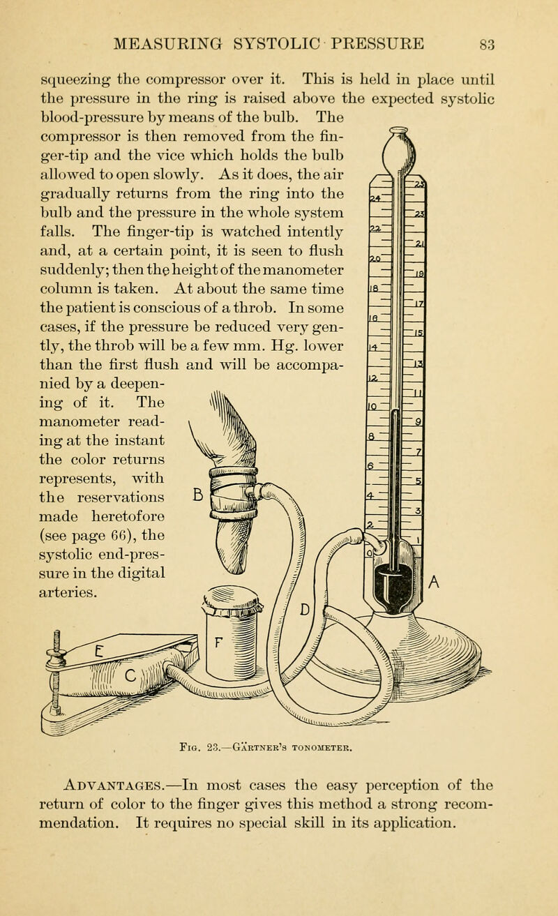 squeezing the compressor over it. This is held in place until the pressure in the ring is raised above the expected systolic blood-pressure by means of the bulb. The compressor is then removed from the fin- ger-tip and the vice which holds the bulb allowed to open slowly. As it does, the air gradually returns from the ring into the bulb and the pressure in the whole system falls. The finger-tip is watched intently and, at a certain point, it is seen to flush suddenly; then the height of the manometer column is taken. At about the same time the patient is conscious of a throb. In some cases, if the pressure be reduced very gen- tly, the throb will be a few mm. Hg. lower than the first fiush and will be accompa- nied by a deepen- ing of it. The manometer read- ing at the instant the color returns represents, with the reservations made heretofore (see page 66), the systolic end-pres- sure in the digital arteries. / C Fig. 23.—Gartner's tonometer. Advantages.—In most cases the easy perception of the return of color to the finger gives this method a strong recom- mendation. It requires no special skill in its apphcation.