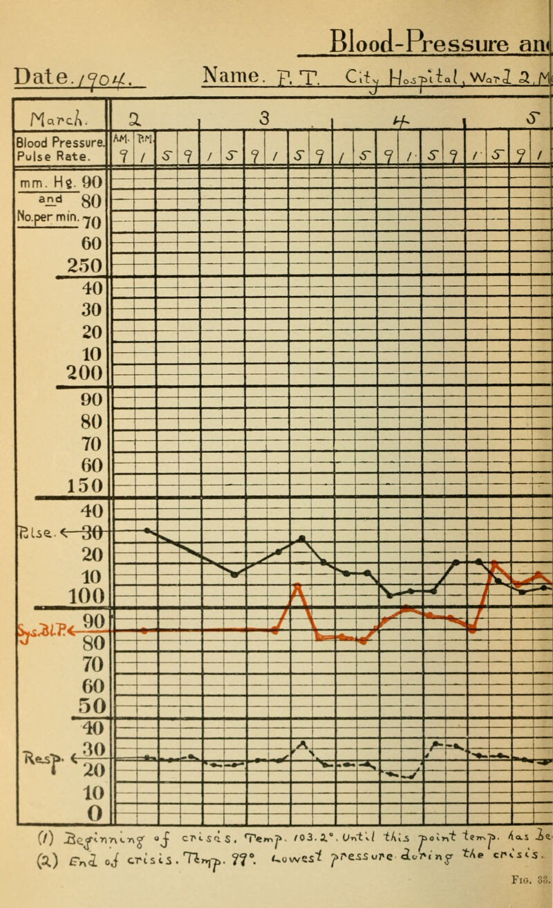 Blood-Pressure an< Date./yoy. N ame. ? . T. Clt, H o^Vl t »l, w ,rd[ 5 A J 1 1 NarcA. a , 3 . , ^ 1 J- Blood Pressure. Pulse Rate. AM. ? / S 7 / ^ ± / «^ ? / ;r 7 /■ 6- ? / >5~ -Z. _/_ mm. H$. 90 ■^ ,^_ —f — ^Hd 80 No.per min. -y/^ — — —J . 60 250 — — 1 40 30 20 10 200 , 90 80 70 60 150 r 1 1 1 1 ■ 1 1 ! . 1 1 i 1 1 ■ 1 1 40 ^^ 1 1 1 CliSl < JO 20 10 100 -^ ^ i 1 ^1 s^ 1^ :_s. ^^ ^ ! ^ V ^ ^•s^ ^ •s ^ ■^ ^ ^ ^^ J y^\ ^f *s H V -/ i x^ L— H-T* ^ ^mm .. —. T 1 c .->i~o^ yO -j/ —^ . ^ *^ j^ 70 60 50 r 1 ^ ^ ^ * 1 1 1 1 40 1 1 — A /»- «^ i -1 ■ - ~*^ 1 ■->• f '< i « r ' ■'♦- -■^-^ ^^?' ^ 20 10 0 '--—>* r ■*«: ••• -*. l*^ .V 1 -- 1 1 j _.,' 1 1 (f) 3c^<ri ■i is . 7^ s. <,0 we. • a. ire 55 «J re jy d.t.7 cr Fio. s. 33.