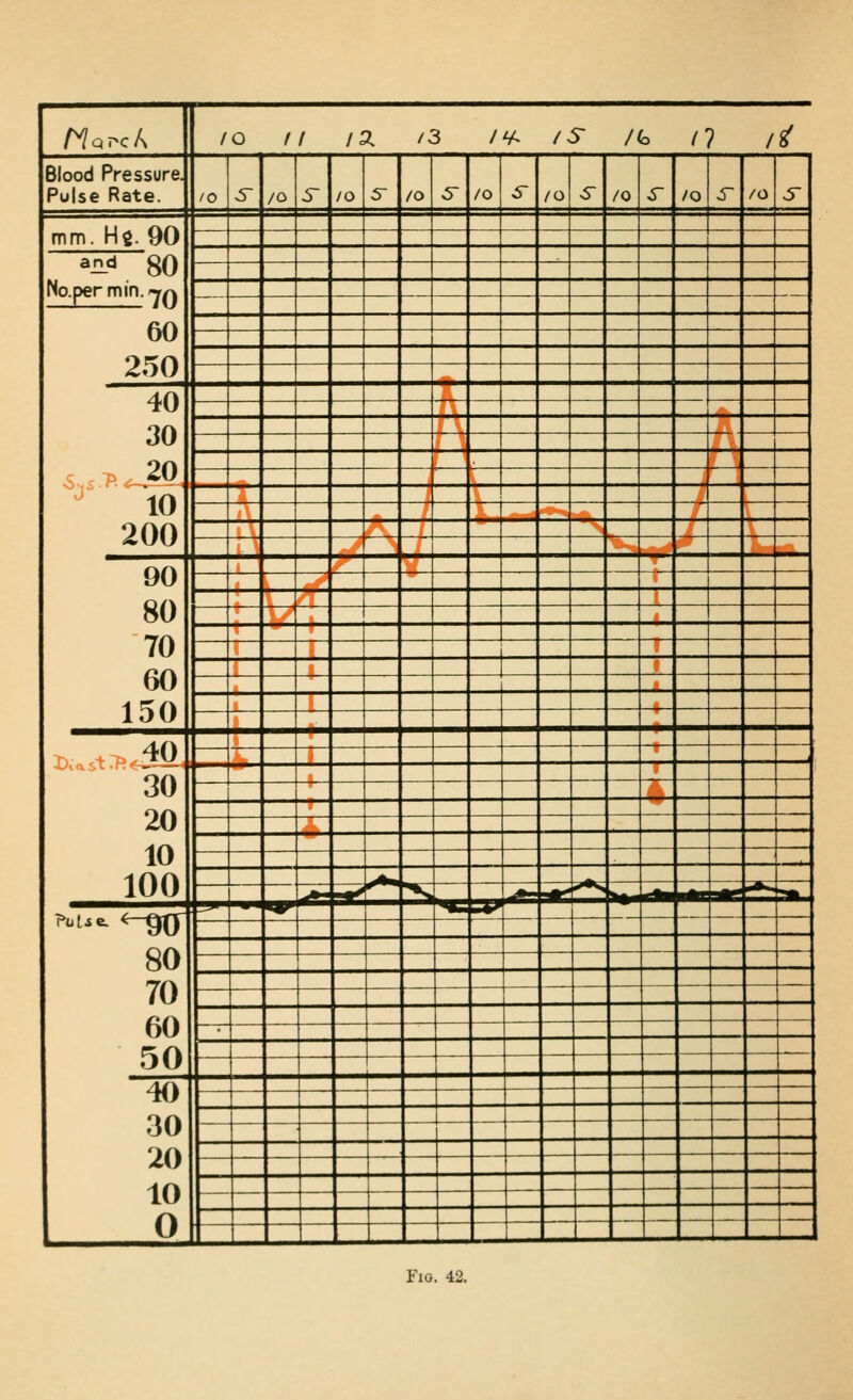 HarcA /o ff /a. /3 /^ /s /(o /? /g' Blood Pressure. Pulse Rate. 10 6~ /o 5 /o 5 /o 5- /o 5- /o ^ /o s- /o ^ /o J mm. Hs. 90 ^n.^ 80 No.per mm.-y^ — — — 60 250 40 30 ^ 10 200 90 80 70 60 150 ' ,,,^ ^___ ___ D..t^.40 30 20 10 100 » 4 —*> ^*- ^^ — .»^ 80 70 60 50 ■^ ^ — — — — —— . __ ,^ _„ 40 30 20 10 0 1 ' — _ — — — — — — L ^^^