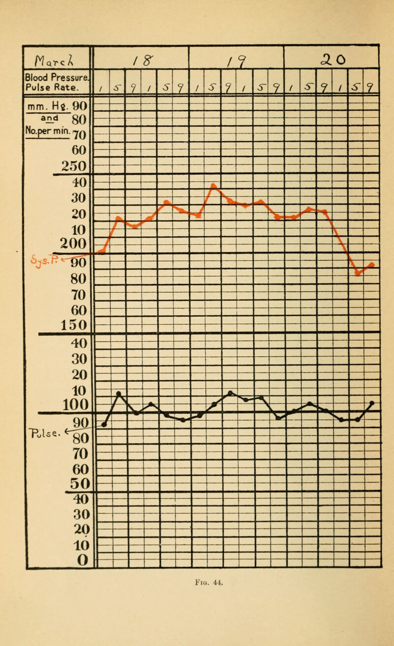 /^arcA / 8- /? AO Blood Pressure. Pulse Rate. / s ? / 6 1 / 6~ 1. / s- ? / 5~ 7 / s 7 mm. Hg. 90 ■■^ ■^~ ^nP 80 No.permin.Trrv 60 250 — 40 30 20 10 200 W f\ 1 I& 'i X.. ^,, ^js. 1^-90 80 70 60 150 ■ V _ ' 40 30 20 10 100 ' ^ JL .jt^ A ^ ^^ >^ •\ ^ r ^ ^ /:. > ^Mi ^^ ^^ t- 9a PoUe. ^ 70 60 50 7 ^ ^ 17 J 40 30 20 10 0 _ ^_ Imo. 44.