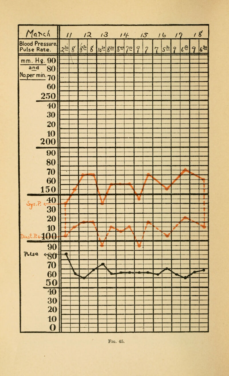 AfQ>cA // /5 /3 iH^ IS Ho n 1^ Blood Pressure. Pulse Rate. 3^^ ^ ■^- ^ /o^- ^4£ S~ 0(0 1 1 1 J^ 1. ^^° ? 6^-2 mm. Hg. 90 ^il«=» 80 No.permin.'Y^ 1 60 250 — —— 40 30 20 10 200 — 90 80 70 60 150 r .   ' ^.Pc^O r ^^ ^30 20 10 Ix^tT^ 100 ^ ■in **  90 -~m r-Lse ^80 70 60 50 A 1 v ^ \ /' V _._^ / ^^ s Jt^ >•• ^ ^ *«r *s ^ 40 30 20 10 0 ■ ■ __ _ ^^^ Fig. 45.