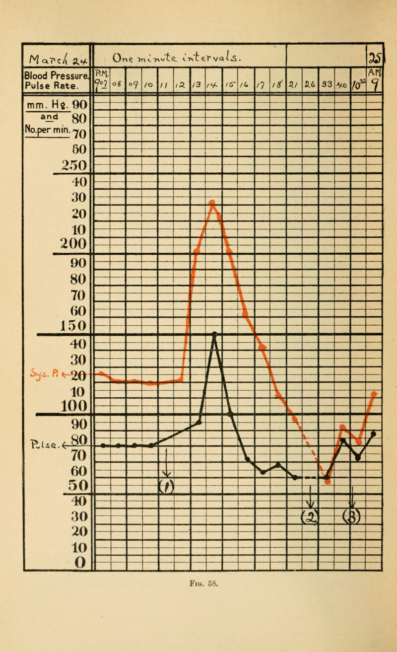 MctJx a,v. One-hiC7>v1:e, t.'rv'terva/^. 3^ Blood Pressure. Pulse Rate. Qo2 OS °7 /o II la. /3 /'A /S' /U /? /^ 5/ fi- 6 33 Vo /o^ AM 7 mm. Hg. 90 ^nsi 80 No.permin.-y^ — 60 250 40 30 20 10 200 [~ , 90 80 70 60 150 g i E _J 1 \ \ \ \ \ \ ^ 1 40 30 V^«-20 10 100 ^ T V V A ¥ il /\ ^ / 1 i. rn t-S^ .,_- 1 \ n V [ ^ -X 1..,. ,'■■ 90  *^ X \ ^ ^ ^ ^ ^^ I V > 1**^ V \ /^ 70 60 50 \ \ w> V ^—k^— V ^ ^^ A nr v^ ^r* Vi ■ J fa\ ^ J) 40 30 20 10 0 V ( ' i 0 ( jS \<= c \ V Fio. 58.