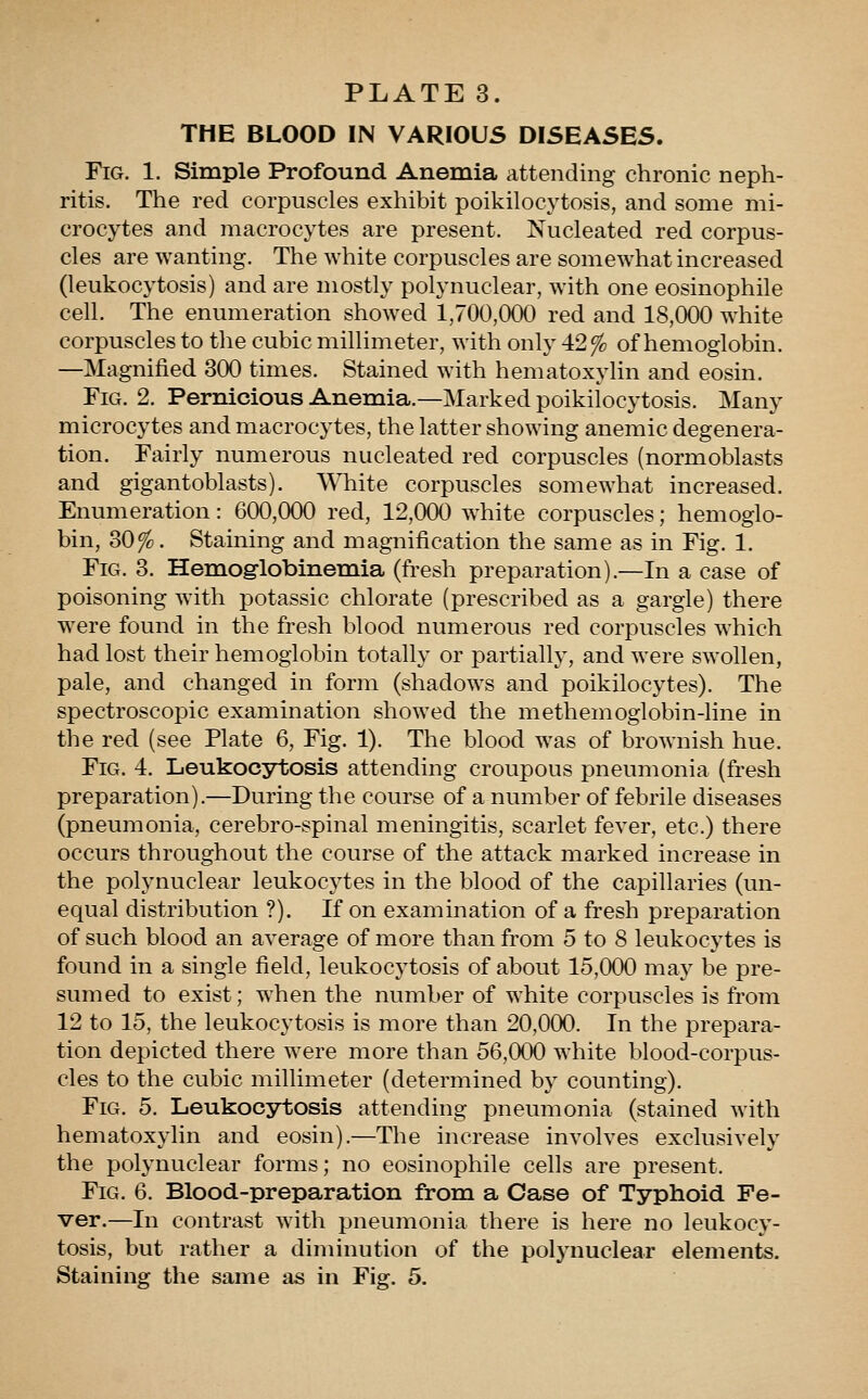 THE BLOOD IN VARIOUS DISEASES. Fig. 1. Simple Profound Anemia attending chronic neph- ritis. The red corpuscles exhibit poikilocytosis, and some mi- crocytes and macrocytes are present. Nucleated red corpus- cles are wanting. The white corpuscles are somewhat increased (leukocytosis) and are mostly polynuclear, with one eosinophile cell. The enumeration showed 1,700,000 red and 18,000 white corpuscles to the cubic millimeter, with only 42% of hemoglobin. —Magnified 300 times. Stained with hematoxylin and eosin. Fig. 2. Pernicious Anemia.—Marked poikilocytosis. Many microcytes and macrocytes, the latter showing anemic degenera- tion. Fairly numerous nucleated red corpuscles (normoblasts and gigantoblasts). White corpuscles somewhat increased. Enumeration: 600,000 red, 12,000 white corpuscles; hemoglo- bin, 30%. Staining and magnification the same as in Fig. 1. Fig. 3. Hemoglobinemia (fresh preparation).—In a case of poisoning with potassic chlorate (prescribed as a gargle) there were found in the fresh blood numerous red corpuscles which had lost their hemoglobin totally or partially, and were swollen, pale, and changed in form (shadows and poikilocytes). The spectroscopic examination showed the methemoglobin-line in the red (see Plate 6, Fig. 1). The blood was of brownish hue. Fig. 4. Leukocytosis attending croupous pneumonia (fresh preparation).—During the course of a number of febrile diseases (pneumonia, cerebro-spinal meningitis, scarlet fever, etc.) there occurs throughout the course of the attack marked increase in the polynuclear leukocytes in the blood of the capillaries (un- equal distribution ?). If on examination of a fresh preparation of such blood an average of more than from 5 to 8 leukocytes is found in a single field, leukocytosis of about 15,000 may be pre- sumed to exist; when the number of white corpuscles is from 12 to 15, the leukocytosis is more than 20,000. In the prepara- tion depicted there were more than 56,000 white blood-corpus- cles to the cubic millimeter (determined by counting). Fig. 5. Leukocytosis attending pneumonia (stained with hematoxylin and eosin).—The increase involves exclusively the polynuclear forms; no eosinophile cells are present. Fig. 6. Blood-preparation from a Case of Typhoid Fe- ver.—In contrast with pneumonia there is here no leukocy- tosis, but rather a diminution of the polynuclear elements. Staining the same as in Fig. 5.