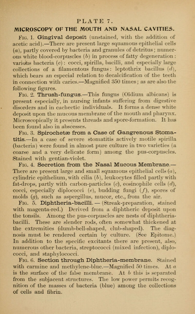 MICROSCOPY OF THE MOUTH AND NA5AL CAVITIES. Fig. 1. Gingival deposit (unstained, with the addition of acetic acid).—There are present large squamous epithelial cells {a), partly covered by bacteria and granules of detritus; numer- ous white blood-corpuscles (6) in process of fatty degeneration: variolis bacteria (c): cocci, spirilla, bacilli, and especially large collections of a filamentous fungus: leptothrix bacillus [d], which bears an especial relation to decalcification of the teeth in connection with caries.—Magnified 350 times; as are also the following figures. Fig. 2. Thrush-fungus.—This fungus (Oidium albicans) is present especially, in nursing infants suffering from digestive disorders and in cachectic individuals. It forms a dense white deposit upon the mucous membrane of the mouth and pharynx. Microscopically it presents threads and spore-formation. It has been found also in abscesses. Fig. 3. Spirochetse from a Case of Gangrenous Stoma- titis.—In a case of severe stomatitis actively motile spirilla (bacteria) were found in almost pure culture in two varieties (a coarse and a very delicate form) among the pus-corpuscles. Stained with gentian-violet. Fig. 4. Secretion from the Nasal Mucous Membrane.— There are present large and small squamous epithelial cells (a), cylindric epithelium, with cilia [b], leukocytes filled partly with fat-drops, partly with carbon-particles (c), eosinophile cells [d), cocci, especially diplococci [e), budding fungi {/), spores of molds (g), such as aspergillus, mucor, etc., from the air. Fig. 5. Diphtheria-bacilli. — (Streak-preparation, stained with magenta-red.) Derived from a diphtheric deposit upon the tonsils. Among the pus-corpuscles are nests of diphtheria- bacilli. These are slender rods, often somewhat thickened at the extremities (dumb-bell-shaped, club-shaped). The diag- nosis must be rendered certain by culture. (See Epitome.) In addition to the specific excitants there are present, also, numerous other bacteria, streptococci (mixed infection), diplo- cocci, and staphylococci. Fig. 6. Section through Diphtheria-membrane. Stained with carmine and methylene-blue.—Magnified 50 times. At a is the surface of the false membrane. At b this is separated from the subjacent structures. The low power permits recog- nition of the masses of bacteria (blue) among the collections of cells and fibrin.