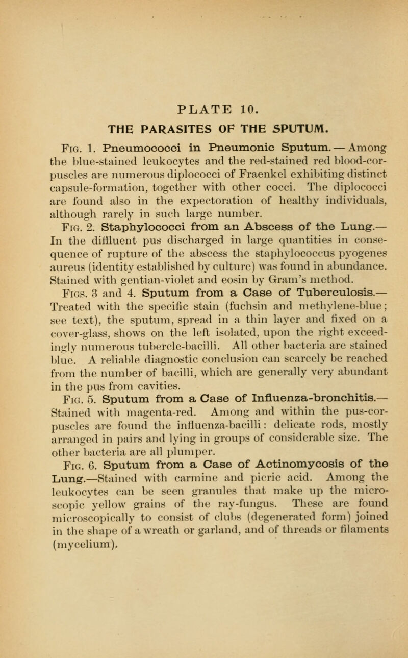 THE PARASITES OF THE SPUTUM. Fig. 1. Pneumococci in Pneumonic Sputum. — Among the blue-stained leukocytes and the red-stained red blood-cor- puscles are numerous diplococci of Fraenkel exhibiting distinct capsule-formation, together with other cocci. The diplococci are found also in the expectoration of healthy individuals, although rarely in such large number. Fig. 2. Staphylococci from an Abscess of the Lung.— In the diffluent pus discharged in large quantities in conse- quence of rupture of the abscess the staphylococcus pyogenes aureus (identity established by culture) was found in abundance. Stained with gentian-violet and eosin by Gram's method. Figs. 3 and 4. Sputum from a Case of Tuberculosis.— Treated with the specific stain (fuchsin and methylene-blue; see text), the sputum, spread in a thin layer and fixed on a cover-glass, shows on the left isolated, upon the right exceed- ingly munerous tubercle-bacilli. All other bacteria are stained blue. A reliable diagnostic conclusion can scarcely be reached from the number of bacilli, which are generally very abundant in the pus from cavities. Fig. 5. Sputum from a Case of Influenza-bronchitis.— Stained with magenta-red. Among and within the pus-cor- puscles are found the influenza-bacilli: delicate rods, mostly arranged in pairs and lying in groups of considerable size. The other bacteria are all i)lumper. Fig. 6. Sputum from a Case of Actinomycosis of the Lung.—Stained with carmine and picric acid. Among the leukocytes can be seen granules that make up the micro- scopic yellow grains of the ray-fungus. These are found microscopically to consist of clubs (degenerated form) joined in the shape of a wreath or garland, and of threads or filaments (mycelium).