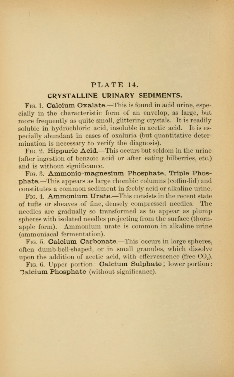 CRYSTALLINE URINARY SEDIMENTS. Fig. 1. Calcium Oxalate.—This is found in acid urine, espe- cially in the characteristic form of an envelop, as large, but more frequently as quite small, glittering crystals. It is readily soluble in hydrochloric acid, insoluble in acetic acid. It is es- pecially abundant in cases of oxaluria (but quantitative deter- mination is necessary to verify the diagnosis). Fig. 2. Hippuric Acid.—This occurs but seldom in the urine (after ingestion of benzoic acid or after eating bilberries, etc.) and is without significance. Fig. 3. Ammonio-niagnesium Phosphate, Triple Phos- phate.—This appears as large rhombic cokimns (coffin-lid) and constitutes a common sediment in feebly acid or alkaline urine. Fig, 4. Animonium Urate.—This consists in the recent state of tufts or sheaves of fine, densely compressed needles. The needles are gradually so transformed as to appear as plump spheres with isolated needles projecting from the surface (thorn- apple form). Ammonium urate is common in alkaline urine (ammoniacal fermentation). Fig. 5. Calcium Carbonate.—This occurs in large spheres, often dumb-bell-shaped, or in small granules, which dissolve upon the addition of acetic acid, with effervescence (free CO.J. Fig. 6. Upper portion : Calcium Sulphate ; lower portion : 'Calcium Phosphate (without significance).