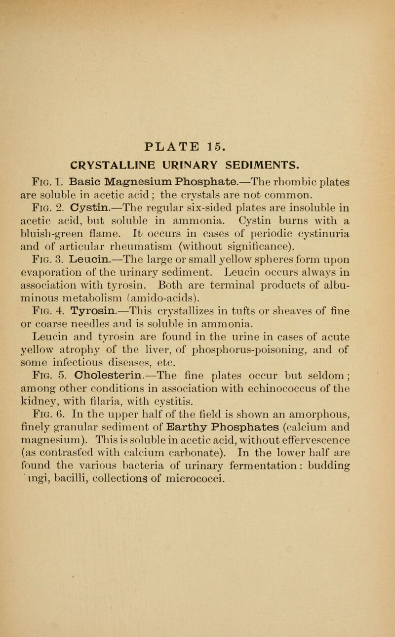 CRYSTALLINE URINARY SEDIMENTS. Fig. 1. Basic Mag-nesium Phosphate.—The rhombic plates are soluble in acetic acid; the crystals are not common. Fig. 2. Cystin.—The regular six-sided plates are insoluble in acetic acid, but soluble in ammonia. Cystin burns with a bluish-green flame. It occurs in cases of periodic cystinuria and of articular rheumatism (without significance). Fig. 3. Leucin.—The large or small yellow spheres form upon evaporation of the urinary sediment. Leucin occurs always in association with tyrosin. Both are terminal products of albu- minous metabolism (amido-acids). Fig. 4. Tyrosin.—This crystallizes in tufts or sheaves of fine or coarse needles and is soluble in ammonia. Leucin and tyrosin are found in the urine in cases of acute yellow atrophy of the liver, of phosphorus-poisoning, and of some infectious diseases, etc. Fig. 5. Cholesterin.—The fine plates occur but seldom ; among other conditions in association with echinococcus of the kidney, with filaria, with cystitis. Fig. 6. Li the ui)per half of the field is shown an amorphous, finely granular sediment of Earthy Phosphates (calcium and magnesium). This is sokible in acetic acid, without effervescence (as contrasted with calcium carbonate). In the lower half are found the various bacteria of urinary fermentation: budding ■ mgi, bacilli, collections of micrococci.