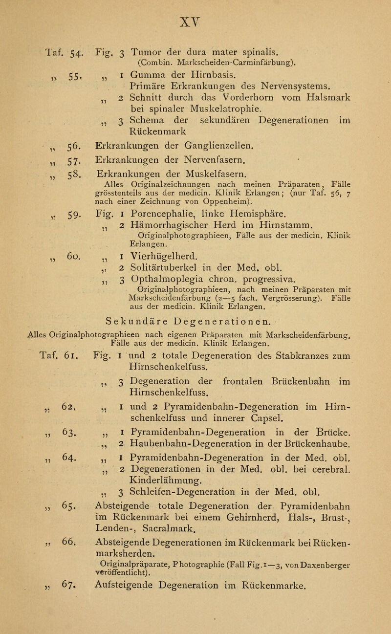 11 2 •n I V 2 57 3 XY laf, 54, Fig. 3 Tumor der dura mater spinalis. (Combin. Markscheiden-Carminfarbung). ,, 55. „ I Gumma der Hirnbasis. Primare Erkrankungen des Nervensystems. ,, 2 Schnitt durch das Vorderhorn vom Halsmark bei spinaler Muskelatrophie. „ 3 vSchema der sekundaren Degenerationen im Riickenmark „ 56. Erkrankungen der Ganglienzellen. ,, 57. Erkrankungen der Nervenfasern. ,, 58. Erkrankungen der Muskelfasern, Alles Originalzeichnungen nach meinen Praparaten, Falle grosstenteils aus der medicin. Klinik Erlangen; (nur Taf. 56, 7 nach einer Zeichnung von Oppenheim). Hamorrhagischer Herd im Hirnstamm. Originalphotographieen, Falle aus der medicin. Klinik Erlangen. 60. „ I Vierhugelherd. Solitartuberkel in der Med. obi. Opthalmoplegia chron, progressiva. Originalphotographieen, nach meinen Praparaten mit Markscheidenfarbung (2—5 fach. Vergrosserung). Falle aus der medicin. Klinik Erlangen. Sekundare Degenerationen. Alles Originalphotographieen nach eigenen Praparaten mit Markscheidenfarbung, Falle aus der medicin. Klinik Erlangen. Taf. 61. Fig. I und 2 totale Degeneration des Stabkranzes zum Hirnschenkelfuss. 11 3 Degeneration der frontalen Brtickenbahn im Hirnschenkelfuss. „ 62. „ I und 2 Pyramidenbahn-Degeneration im Hirn- schenkelfuss und innerer Capsel. ,, 63. ,, I Pyramidenbahn-Degeneration in der Briicke. ,, 2 Haubenbahn-Degeneration in der Briickenhaube. ,, 64. ,, I Pyramidenbahn-Degeneration in der Med. obi, ,, 2 Degenerationen in der Med, obi. bei cerebral. Kinderlahmung, „ 3 Schleifen-Degeneration in der Med. obi, ,, 65. Absteigende totale Degeneration der Pyramidenbahn im Riickenmark bei einem Gehirnherd, Hals-, Brust-, Lenden-, Sacralmark. ,, 66. Absteigende Degenerationen im Riickenmark bei Riicken- marksherden. Originalpraparate, Photographic (Fall Fig.1—3, vonDaxenberger vcroffentlicht). „ 67. Aufsteigende Degeneration im Riickenmarke.