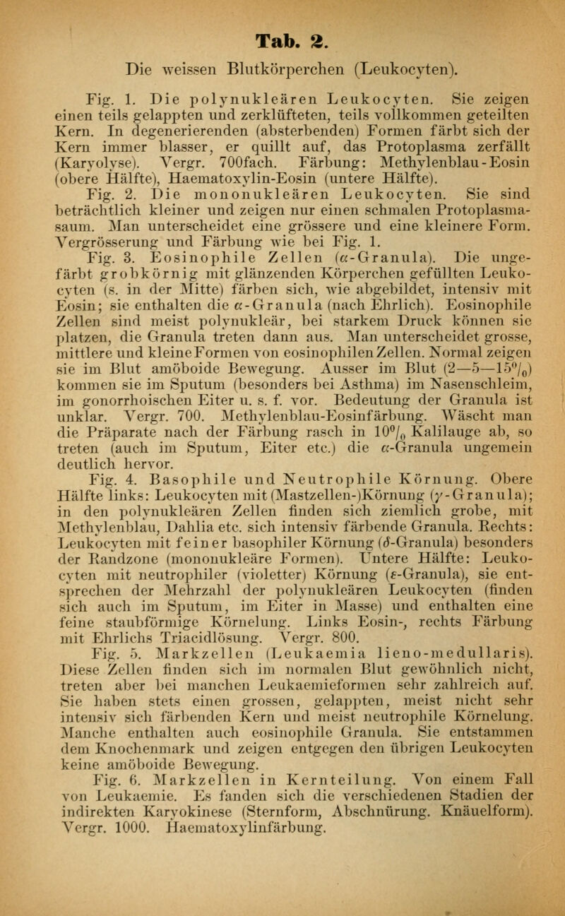 Die weissen Blutkörperchen (Leukocyten). Fig. 1. Die polynukleären Leukocyten. Sie zeigen einen teils gelappten und zerklüfteten, teils vollkommen geteilten Kern. In degenerierenden (absterbenden) Formen färbt sich der Kern immer blasser, er quillt auf, das Protoplasma zerfällt (Karyolyse). Vergr. 700fach. Färbung: Methylenblau - Eosin (obere Hälfte), Haematoxylin-Eosin (untere Hälfte). Fig. 2. Die mononukleären Leukocyten. Sie sind beträchtlich kleiner und zeigen nur einen schmalen Protoplasma- saum. Man unterscheidet eine grössere und eine kleinere Form. Vergrösserung und Färbung wie bei Fig. 1. Fig. 3. Eosinophile Zellen («-Granula). Die unge- färbt grobkörnig mit glänzenden Körperchen gefüllten Leuko- cyten (s. in der Mitte) färben sich, wie abgebildet, intensiv mit Eosin; sie enthalten die «-Granula (nach Ehrlich). Eosinophile Zellen sind meist polynukleär, bei starkem Druck können sie platzen, die Granula treten dann aus. Man unterscheidet grosse, mittlere und kleine Formen von eosinophilen Zellen. Normal zeigen sie im Blut amöboide Bewegung. Ausser im Blut (2—5—15°/0) kommen sie im Sputum (besonders bei Asthma) im Nasenschleim, im gonorrhoischen Eiter u. s. f. vor. Bedeutung der Granula ist unklar. Vergr. 700. Methylenblau-Eosinfärbung. Wäscht man die Präparate nach der Färbung rasch in 10°/0 Kalilauge ab, so treten (auch im Sputum, Eiter etc.) die «-Granula ungemein deutlich hervor. Fig. 4. Basophile und Neutropenie Körnung. Obere Hälfte links: Leukocyten mit (Mastzellen-)Körnung (/-Granula); in den polynukleären Zellen finden sich ziemlich grobe, mit Methylenblau, Dahlia etc. sich intensiv färbende Granula. Rechts: Leukocyten mit feiner basophiler Körnung (rf-Granula) besonders der Randzone (mononukleäre Formen). Untere Hälfte: Leuko- cyten mit neutrophiler (violetter) Körnung (e-Granula), sie ent- sprechen der Mehrzahl der polynukleären Leukocyten (finden sich auch im Sputum, im Eiter in Masse) und enthalten eine feine staubförmige Körnelung. Links Eosin-, rechts Färbung mit Ehrlichs Triacidlösung. Vergr. 800. Fig. 5. Markzellen (Leukaemia lieno-medullaris). Diese Zellen finden sich im normalen Blut gewöhnlich nicht, treten aber bei manchen Leukaemieformen sehr zahlreich auf. Sie haben stets einen grossen, gelappten, meist nicht sehr intensiv sich färbenden Kern und meist neutrophile Körnelung. Manche enthalten auch eosinophile Granula. Sie entstammen dem Knochenmark und zeigen entgegen den übrigen Leukocyten keine amöboide Bewegung. Fig. 6. Markzellen in Kernteilung. Von einem Fall von Leukaemie. Es fanden sich die verschiedenen Stadien der indirekten Karyokinese (Sternform, Abschnürung. Knäuelform). Vergr. 1000. Haematoxylinfärbung.