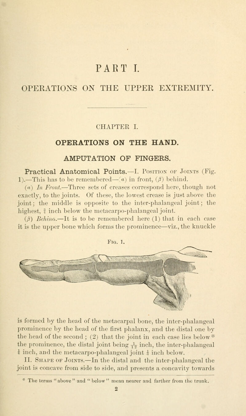 PART I. OPERATIONS ON THE UPPER EXTREMITY. CHAPTER I. OPERATIONS ON THE HAND. AMPUTATION OF FINGERS. Practical Anatomical Points.—I. Position of Joints (Fig. 1).—This has to be remembered—'.a) in front, (/3) behind. («) In Front.—Three sets of creases correspond here, though not exactly, to the joints. Of these, the lowest crease is just above the joint; the middle is opposite to the inter-phalangeal joint; the highest, 4 inch below the metacarpo-phalangeal joint. {[i) Behina.—It is to be remembered here (1) that in each case it is the upper bone which forms the prominence—viz., the knuckle Fig. 1. is formed by the head of the metacarpal bone, the inter-phalangeal prominence by the head of the first phalanx, and the distal one by the head of the second ; (2) that the joint in each case lies below* the prominence, the distal joint being -^ inch, the inter-phalangeal i inch, and the metacarpo-phalangeal joint i inch below. II. Shape of Joints.—In the distal and the inter-phalangeal the joint is concave from side to side, and presents a concavity towards * The terms above and  below mean nearer and farther from the trunk.