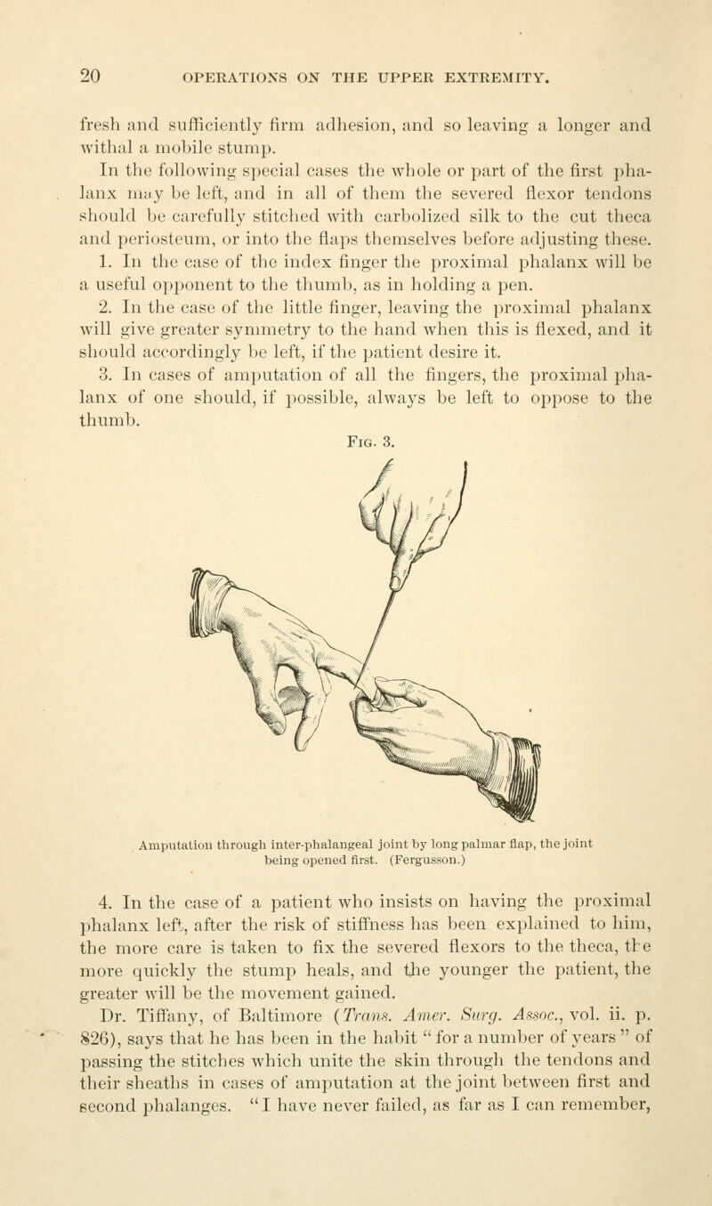 fresh and sufficiently firm adhesion, and so leaving a longer and withal a mobile stump. In the following special cases the whole or part of the first pha- lanx m<iy be left, and in all of them the severed flexor tendons should be carefully stitched with carbolized silk to the cut theca and periosteum, or into the flaps themselves before adjusting these. 1. In the case of the index finger the proximal phalanx will be a useful opponent to the thumb, as in holding a pen. 2. In the case of the little finger, leaving the proximal phalanx will give greater symmetry to the hand when this is flexed, and it should accordingly be left, if the patient desire it. 3. In cases of amputation of all the fingers, the proximal pha- lanx of one should, if possible, always be left to oppose to the thumb. Fig. 3. Amputation through inter-phalangeal joint by long palmar flap, the joint being opened first. (Fergusson.) 4. In the case of a patient who insists on having the proximal phalanx left, after the risk of stiffness has been explained to him, the more care is taken to fix the severed flexors to the theca, the more quickly the stump heals, and tlie younger the patient, the greater will be the movement gained. Dr. Tifiany, of Baltimore (Trans. Amer. Surg, ^s-soc, vol. ii. p. 826), says that he has been in the habit  for a number of years  of passing the stitches which unite the skin through the tendons and their sheaths in cases of amputation at the joint between first and second phalanges. I have never failed, as far as I can remember,