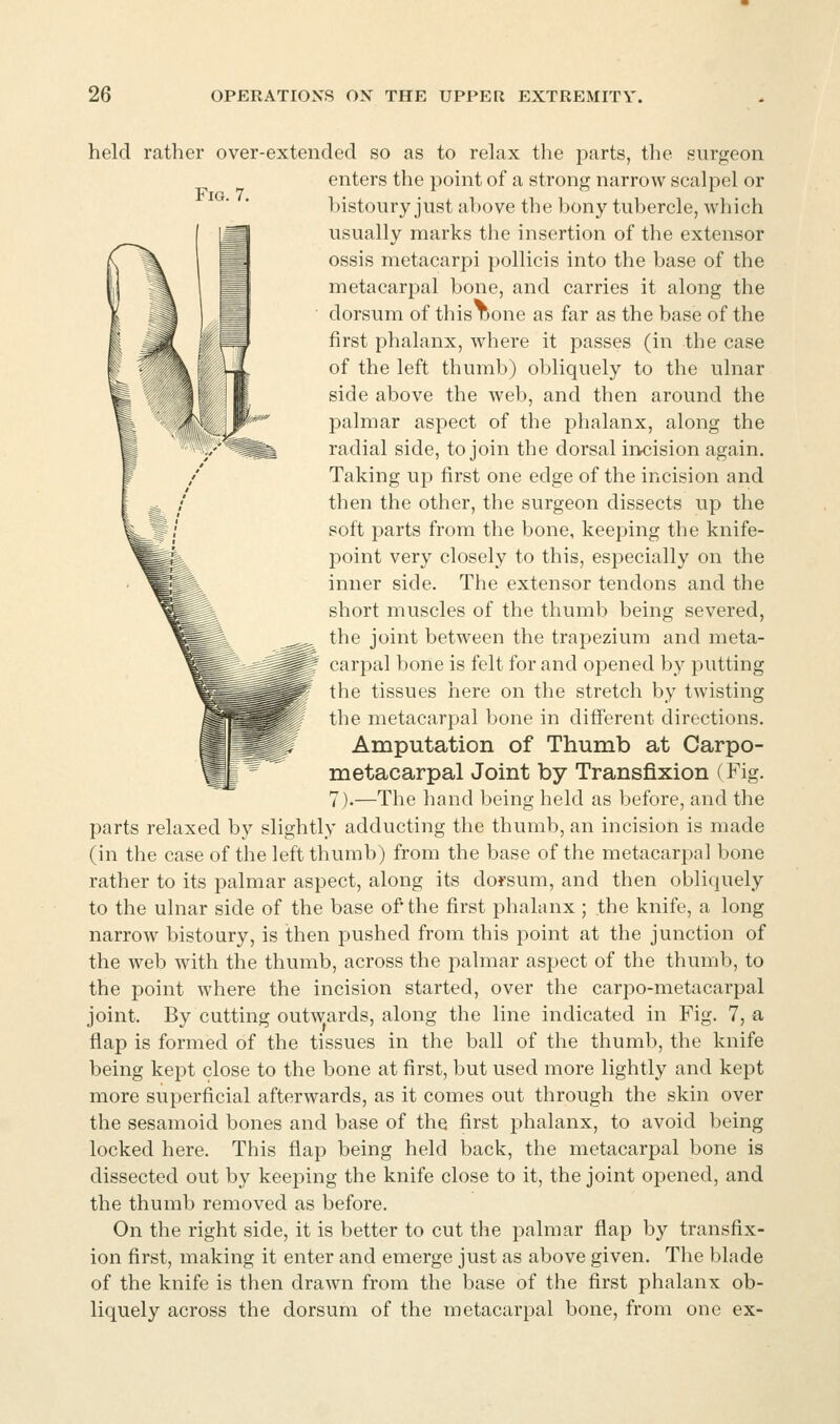 Fig. 7. held rather over-extended so as to relax the i^arts, the surgeon enters the point of a strong narrow scalpel or histoury just above the bony tubercle, which usually marks the insertion of the extensor ossis metacarpi pollicis into the base of the metacarpal bone, and carries it along the dorsum of this none as far as the base of the first phalanx, where it passes (in the case of the left thumb) obliquely to the ulnar side above the Aveb, and then around the palmar aspect of the phalanx, along the radial side, to join the dorsal incision again. Taking up first one edge of the incision and then the other, the surgeon dissects up the soft parts from the bone, keeping the knife- point very closely to this, especially on the inner side. The extensor tendons and the short muscles of the thumb being severed, the joint between the trapezium and meta- carpal bone is felt for and opened by putting the tissues here on the stretch by twisting the metacarpal bone in diff*erent directions. Amputation of Thumb at Carpo- metacarpal Joint by Transfixion (Fig. 7).—The hand being held as before, and the parts relaxed by slightly adducting the thumb, an incision is made (in the case of the left thumb) from the base of the metacarpal bone rather to its palmar aspect, along its dorsum, and then obliquely to the ulnar side of the base of the first phalanx ; the knife, a long narrow bistoury, is then pushed from this point at the junction of the web with the thumb, across the palmar aspect of the thumb, to the point where the incision started, over the carpo-metacarpal joint. By cutting outwards, along the line indicated in Fig. 7, a flap is formed of the tissues in the ball of the thumb, the knife being kept close to the bone at first, but used more lightly and kept more superficial afterwards, as it comes out through the skin over the sesamoid bones and base of the first phalanx, to avoid being locked here. This flap being held back, the metacarpal bone is dissected out by keeping the knife close to it, the joint opened, and the thumb removed as before. On the right side, it is better to cut the palmar flap by transfix- ion first, making it enter and emerge just as above given. The blade of the knife is then drawn from the base of the first phalanx ob- liquely across the dorsum of the metacarpal bone, from one ex-