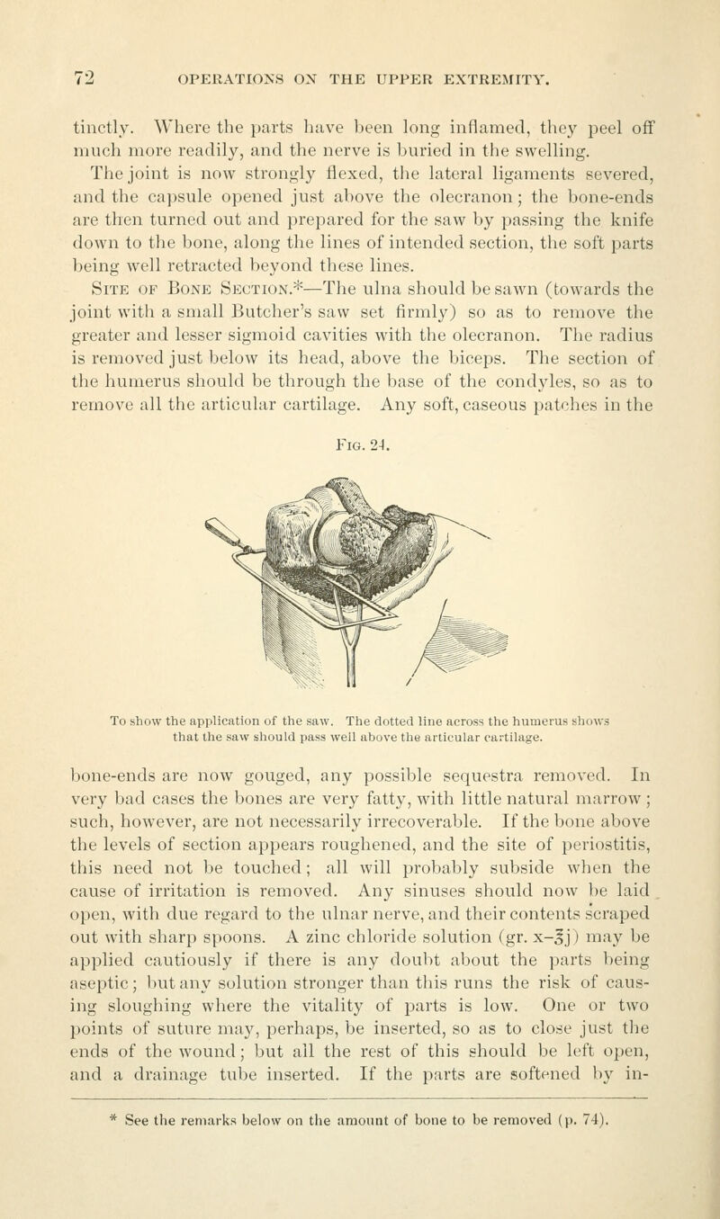 tinctly. Where the parts have been long inflamed, they peel off much more readily, and the nerve is buried in the swelling. The joint is now strongly flexed, the lateral ligaments severed, and the capsule opened just above the olecranon; the bone-ends are then turned out and prepared for the saw by passing the knife down to the bone, along the lines of intended section, the soft parts being well retracted beyond these lines. Site of Bone Section.*—The ulna should be sawn (towards the joint with a small Butcher's saw set firmly) so as to remove the greater and lesser sigmoid cavities with the olecranon. The radius is removed just below its head, above the biceps. The section of the humerus should be through the base of the condyles, so as to remove all the articular cartilage. Any soft, caseous patches in the Fig. 24. To show the application of the saw. The dotted line across the humerus shows that the saw should pass well above the articular cartilage. bone-ends are now gouged, any possible sequestra removed. In very bad cases the bones are very fatty, with little natural marrow ; such, however, are not necessarily irrecoverable. If the bone above the levels of section appears roughened, and the site of periostitis, this need not be touched; all will probably subside when the cause of irritation is removed. Any sinuses should now be laid open, with due regard to the ulnar nerve, and their contents scraped out with sharp spoons. A zinc chloride solution (gr. x-^j) may be applied cautiously if there is any doubt about the parts being aseptic; but any solution stronger than this runs the risk of caus- ing sloughing where the vitality of parts is low. One or two points of suture ma}', perhaps, be inserted, so as to close just the ends of the wound; but all the rest of this should be left open, and a drainage tube inserted. If the parts are softened by in- * See the remarks below on the amount of bone to be removed (p. 74).