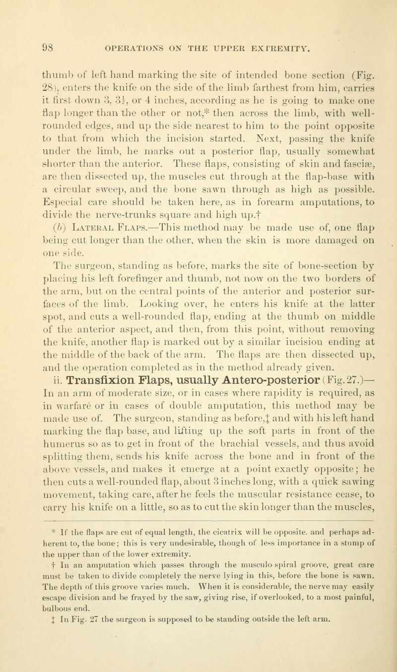 thumb of left liand marking the site of intended bone section (Fig. 28), enters the knife on the side of tlie liml) farthest from him, carries it first down ii, 3.t, or 4 inches, according as he is going to make one flap longer than the other or not,* then across the limb, with Avell- rounded edges, and up the side nearest to him to the point opposite to that from which the incision started. Next, passing the knife under the limb, he marks out a posterior flap, usually somewhat shorter than the anterior. These flaps, consisting of skin and fascise, are then divssected up, the muscles cut through at the flap-base with a circular sweep, and the bone sawn through as high as possible. Especial care should be taken here, as in forearm amputations, to divide the nerve-trunks square and high up.f (b) Lateral Flaps.—This method may be made use of, one flap being cut longer than the other, when the skin is n^ore damaged on one side. The surgeon, standing as before, marks the site of bone-section by placing his left forefinger and thumb, not now on the two borders of the arm, but on the central j^oints of the anterior and posterior sur- faces of the liml). Looking over, he enters his knife at the latter spot, and cuts a well-rounded flap, ending at the thumb on middle of the anterior aspect, and then, from this point, without removing the knife, another flap is marked out by a similar incision ending at the middle of the back of the arm. The flaps are then dissected up, and the operation completed as in the method already given. ii. Transfixion Flaps, usually Antero-posterior(Fig. 27.)— In an arm of moderate size, or in cases where rapidity is required, as in warfare or in cases of double amputation, this method may be made use of. The surgeon, standing as before,| and with his left hand marking the flap base, and lifting up the soft parts in front of the humerus so as to get in front of the brachial vessels, and thus avoid splitting them, sends his knife across the bone and in front of the above vessels, and makes it emerge at a point exactly ojiposite; he then cuts a well-rounded flap, about 3 inches long, with a c{uick sawing movement, taking care, after he feels the muscular resistance cease, to carry his knife on a little, so as to cut the skin longer than the muscles, * If the flaps are cut of equal length, the cicatrix will be opposite, and perhaps ad- herent to, the bone; tills is very nndesirable, though of less importance in a stump of tiie upper than of tlie lower extremity. f In an amputation which passes throngli the musculo sjjiral groove, great care must be taken lo divide completely the nerve lying in this, before the bone is sawn. The depth of this groove varies much. When it is considerable, the nerve may easily escape division and be frayed by the saw, giving rise, if overlooked, to a most painful, bulbous end. X In Fig. 27 the surgeon is supposed to be standing outside the left arm.