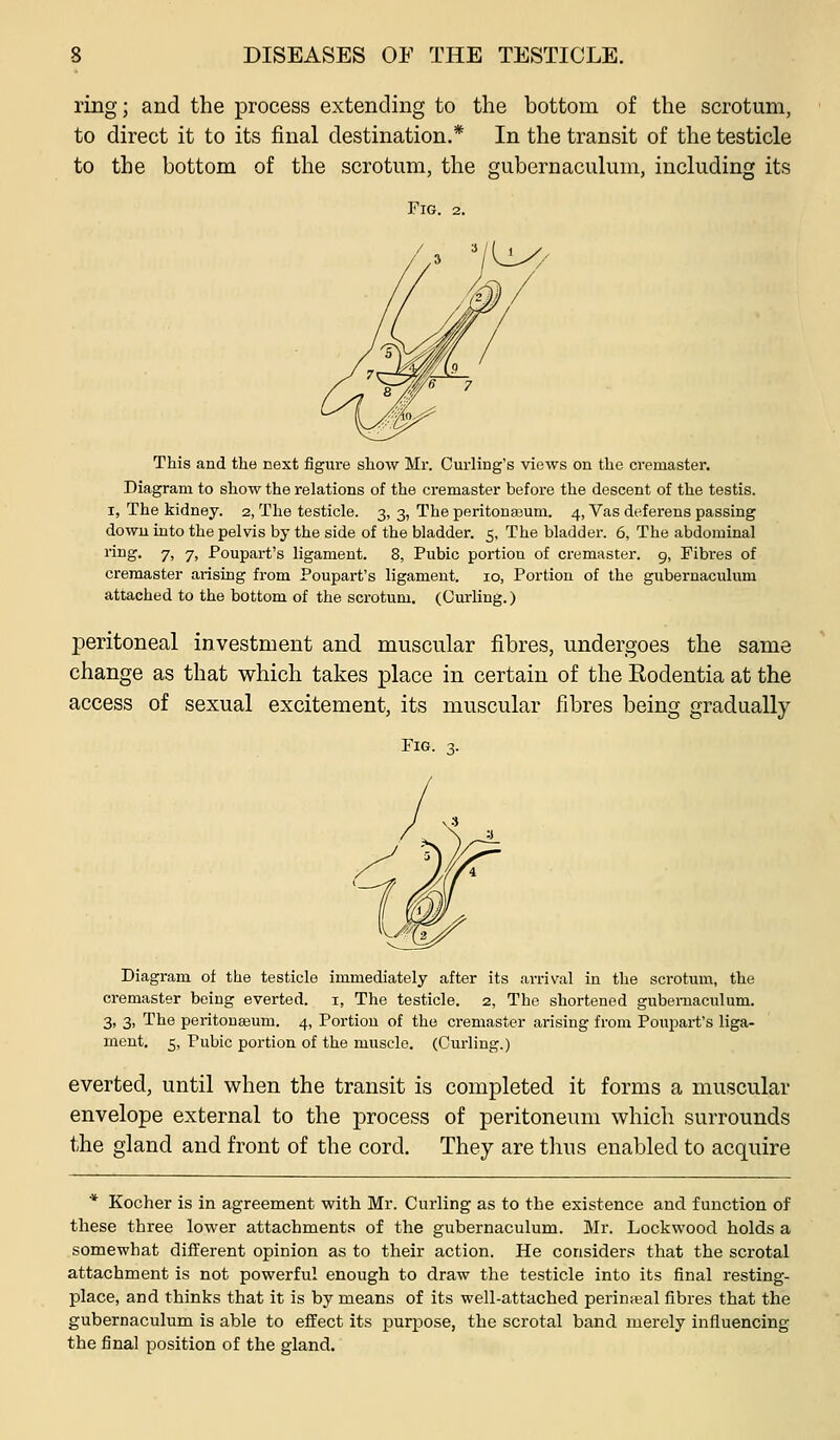 ring; and the process extending to the bottom of the scrotum, to direct it to its final destination.* In the transit of the testicle to the bottom of the scrotum, the gubernaculum, including its Fig. 2. This and the next figure show Mr. Curling's viows on the cremaster. Diagram to show the relations of the cremaster before the descent of the testis. I, The kidney. 2, The testicle. 3, 3, The peritonasum. 4, Vas deferens passing dowu into the pelvis by the side of the bladder. 5, The bladder. 6, The abdominal ring. 7, 7, Poupart's ligament. 8, Pubic portion of cremaster. 9, Pibi'es of cremaster ai-ising from Poupart's ligament. 10, Portion of the gubernaculum attached to the bottom of the scrotum. (Curling.) peritoneal investment and muscular fibres, undergoes the same change as that which takes place in certain of the Rodentia at the access of sexual excitement, its muscular fibres being gradually Fig. ^. Diagram of the testicle immediately after its arrival in the scrotum, the cremaster being everted, i, The testicle. 2, The shortened gubernaculum. 3. 3> The peritonseum. 4, Portion of the cremaster arising from Poupart's liga- ment. 5, Pubic portion of the muscle. (Curling.) everted, until v^hen the transit is completed it forms a muscular envelope external to the process of peritoneum which surrounds the gland and front of the cord. They are thus enabled to acquire * Kocher is in agreement with Mr. Curling as to the existence and function of these three lower attachments of the gubernaculum. Mr. Lockwood holds a somewhat different opinion as to their action. He considers that the scrotal attachment is not powerful enough to draw the testicle into its final resting- place, and thinks that it is by means of its well-attached perinaeal fibres that the gubernaculum is able to effect its purpose, the scrotal band merely influencing the final position of the gland.