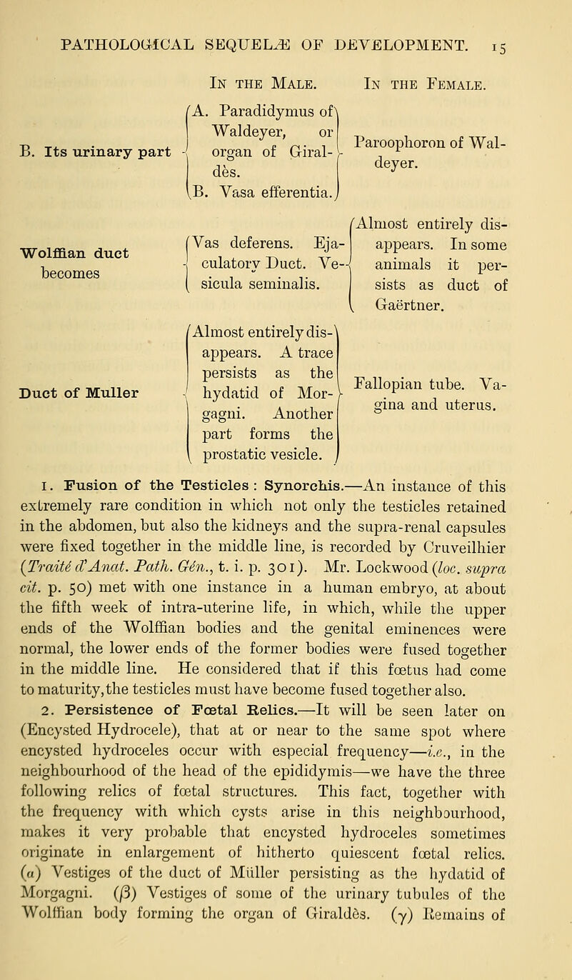 B. Its urinary part In the Male. A. Paradidymus oi\ Waldeyer, or organ of Giral- des. B. Vasa efferentia. In the Female. Paroophoron of Wal- deyer. Wolflaan duct becomes 'Almost entirely dis- Vas deferens. Eja- appears. In some culatory Duct. Ve- animals it per- sicula seminalis. I sists as duct of Gaertner. Duct of Muller ^Almost entirely dis- appears. A trace persists as the hydatid of Mor- gagni. Another part forms the prostatic vesicle. Fallopian tube. Va- gina and uterus. 1. Fusion of the Testicles : Synorchis.—An instance of this exLremely rare condition in which not only the testicles retained in the abdomen, but also the kidneys and the supra-renal capsules were fixed together in the middle line, is recorded by Cruveilhier (Traitsd'Anat. Path. G4n.^ t. i. p. 301). Mr. Lockwood {loc. supra cit. p. 50) met with one instance in a human embryo, at about the fifth week of intra-uterine life, in which, while the upper ends of the Wolffian bodies and the genital eminences were normal, the lower ends of the former bodies were fused together in the middle line. He considered that if this foetus had come to maturity, the testicles must have become fused together also. 2. Persistence of Foetal Relics.—It will be seen later on (Encysted Hydrocele), that at or near to the same spot where encysted hydroceles occur with especial frequency—i.e., in the neighbourhood of the head of the epididymis—we have the three following relics of foetal structures. This fact, together with the frequency with which cysts arise in this neighbourhood, makes it very probable that encysted hydroceles sometimes originate in enlargement of hitherto quiescent foetal relics, (a) Vestiges of the duct of Muller persisting as the hydatid of Morgagni. (/3) Vestiges of some of the urinary tubules of the Wolffian body forming the organ of Griraldos. (y) liemains of