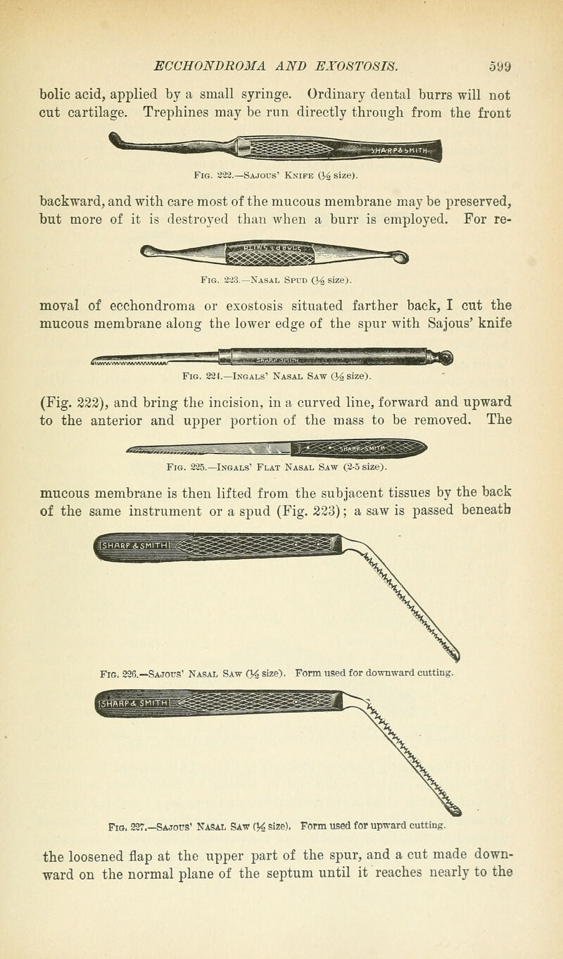 bolic acid, applied by a small syringe. Ordinary dental burrs will not cut cartilage. Trephines may be run directly through from the front Fig. 222.—Sajous1 Knife (]4 size). backward, and with care most of the mucous membrane may be preserved, but more of it is destroyed than when a burr is employed. For re- Fig. 223.—Nasal Spud (}/2 size). moval of ecchondroma or exostosis situated farther back, I cut the mucous membrane along the lower edge of the spur with Sajous' knife Fig. 224.—Ingals' Nasal, Saw (J^size). (Fig. 222), and bring the incision, in a curved line, forward and upward to the anterior and upper portion of the mass to be removed. The Fig. 225.—Ingals' Flat Nasal Saw (2-5 size). mucous membrane is then lifted from the subjacent tissues by the back of the same instrument or a spud (Fig. 223); a saw is passed beneath Fig. 226.—Sajous' Nasal Saw Q4 size). Form used for downward cutting. Fig, 227 Sajous' Nasal Saw (^ size), Form used for upward cutting. the loosened flap at the upper part of the spur, and a cut made down- ward on the normal plane of the septum until it reaches nearly to the