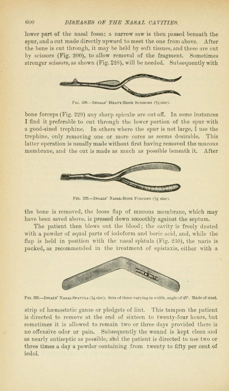 lower part of the nasal fossa; a narrow saw is then passed beneath the spur, and a cut made directly upward to meet the one from above. After the bone is cut through, it may be held by soft tissues, and these are cut by scissors (Fig. 200), to allow removal of the fragment. Sometimes stronger scissors, as shown (Fig. 228), will be needed. Subsequently with Fig. 228.—Ingals1 Heavy-Bone Scissors (V^size). bone forceps (Fig. 229) any sharp spicule are cut off. In some instances I find it preferable to cut through the lower portion of the spur with a good-sized trephine. In others where the spur is not large, I use the trephine, only removing one or more cores as seems desirable. This latter operation is usually made without first having removed the mucous membrane, and the cut is made as much as possible beneath it. After Fig. 229.—Ingals' Nasal-Bone Forceps (% size). the bone is removed, the loose flap of mucous membrane, which may have been saved above, is pressed down smoothly against the septum. The patient then blows out the blood; the cavity is freely dusted with a powder of equal parts of iodoform and boric acid, and, while the flap is held in position with the nasal spatula (Fig. 230), the naris is packed, as recommended in the treatment of epistaxis, either with a Fig. 230.—Ingals' Nasal Spatcla (V2 size). Sets of three varying in width, angle of 45°. Made of steel. strip of haemostatic gauze or pledgets of lint. This tampon the patient is directed to remove at the end of sixteen to twenty-four hours, but sometimes it is allowed to remain two or three days provided there is no offensive odor or pain. Subsequently the wound is kept clean and as nearly antiseptic as possible, and the patient is directed to use two or three times a day a powder containing from twenty to fifty per cent of iodol.