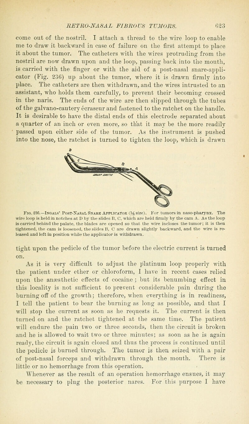 come out of the nostril. I attach a thread to the wire loop to enable me to draw it backward in case of failure on the first attempt to place it about the tumor. The catheters with the wires protruding from the nostril are now drawn upon and the loop, passing back into the mouth, is carried with the finger or with the aid of a post-nasal snare-appli- cator (Fig. 236) up about the tumor, where it is drawn firmly into place. The catheters are then withdrawn, and the wires intrusted to an assistant, who holds them carefully, to prevent their becoming crossed in the naris. The ends of the wire are then slipped through the tubes of the galvano-cautery ecraseur and fastened to the ratchet on the handle. It is desirable to have the distal ends of this electrode separated about a quarter of an inch or even more, so that it may be the more readily passed upon either side of the tumor. As the instrument is pushed into the nose, the ratchet is turned to tighten the loop, which is drawn Fig. 236.—Ingals' Post-Nasal Snare Applicator Q4 size). For tumors in naso-pharynx. The wire loop is held in notches at D by the slides B, C, which are held firmly by the cam A. As the loop is carried behind the palate, the blades are opened so that the wire incloses the tumor; it is then tightened, the cam is loosened, the slides B, C are drawn slightly backward, and the wire is re- leased and left in position while the applicator is withdrawn. tight upon the pedicle of the tumor before the electric current is turned on. As it is very difficult to adjust the platinum loop properly with the patient under ether or chloroform, I have in recent cases relied upon the anaesthetic effects of cocaine ; but its benumbing effect in this locality is not sufficient to prevent considerable pain during the burning off of the growth; therefore, when everything is in readiness, I tell the patient to bear the burning as long as possible, and that I will stop the current as soon as he requests it. The current is then turned on and the ratchet tightened at the same time. The patient will endure the pain two or three seconds, then the circuit is broken and he is allowed to wait two or three minutes; as soon as he is again ready, the circuit is again closed and thus the process is continued until the pedicle is burned through. The tumor is then seized with a pair of post-nasal forceps and withdrawn through the mouth. There is little or no hemorrhage from this operation. Whenever as the result of an operation hemorrhage ensues, it may be necessary to plug the posterior nares. For this purpose I have