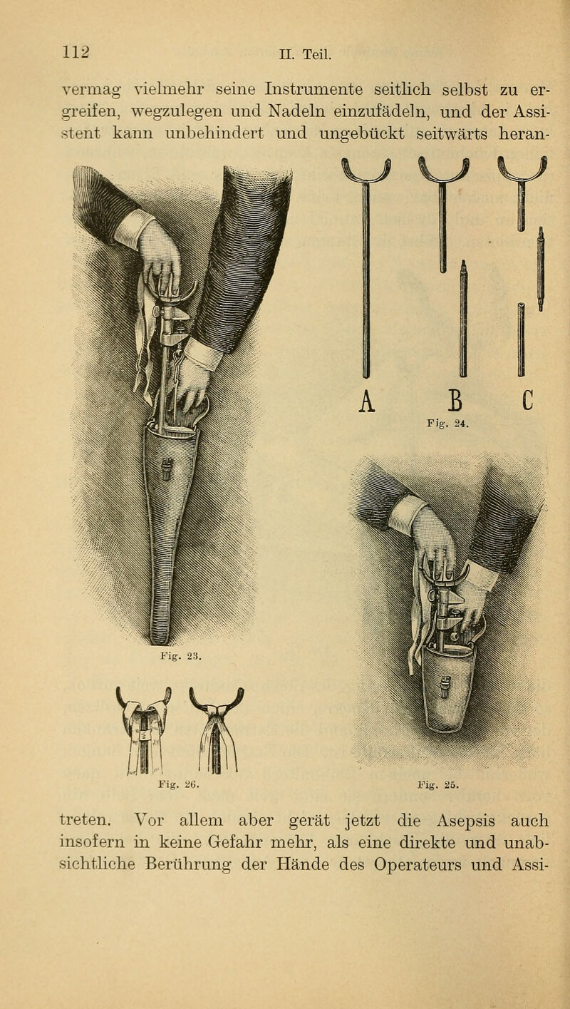 vermag vielmehr seine Instrumente seitlich selbst zu er- greifen, wegzulegen und Nadeln einzufädeln, und. der Assi- stent kann unbehindert und ungebückt seitwärts heran- Flg. ii. Fig. 26. B C Fig. 25. treten. Vor allem aber gerät jetzt die Asepsis auch insofern in keine Gefahr mehr, als eine direkte und unab- sichtliche Berührung der Hände des Operateurs und Assi-