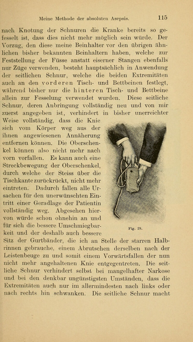 nach Knotung der Schnuren die Kranke bereits so ge- fesselt ist, dass dies nicht mehr möghch sein würde. Der Vorzug, den diese meine Beinhalter vor den übrigen ähn- lichen bisher bekannten Beinhaltern haben, welche zur Feststellung der Füsse anstatt eiserner Stangen ebenfalls nur Züge verwenden, besteht hauptsächlich in Anwendung der seitlichen Schnur, welche die beiden Extremitäten auch an den vorderen Tisch- und Bettbeinen festlegt, während bisher nur die hinteren Tisch- und Bettbeine allein zur Fesselung verwendet wurden. Diese seitliche Schnur, deren Anbringung vollständig neu und von mir zuerst angegeben ist, verhindert in bisher unerreichter Weise vollständig, dass die Knie sich vom Körper weg aus der ihnen angewiesenen Annäherung entfernen können. Die Oberschen- kel können also nicht mehr nach vorn vorfallen. Es kann auch eine Streckbewegung der Oberschenkel, durch welche der Steiss über die Tischkante zurückrückt, nicht mehr eintreten. Dadurch fallen alle Ur- sachen für den unerwünschten Ein- tritt einer Geradlage der Patientin vollständig weg. Abgesehen hier- von würde schon ohnehin an und für sich die bessere Umschmiegbar- keit und der deshalb auch bessere Sitz der Gurtbänder, die ich an Stelle der starren Halb- rinnen gebrauche, einem Abrutschen derselben nach der Leistenbeuge zu und somit einem Vorwärtsfallen der nun nicht mehr angehaltenen Knie entgegentreten. Die seit- liche Schnur verhindert selbst bei mangelhafter Narkose und bei den denkbar ungünstigsten Umständen, dass die Extremitäten auch nur im allermindesten nach links oder nach rechts hin schwanken. Die seitliche Schnur macht