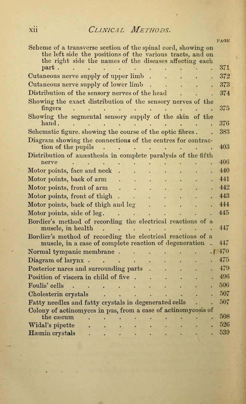 Scheme of a transverse section of the spinal cord, showing on the left side the positions of the various tracts, and on the right side the names of the diseases affecting each part Cutaneous nerve supply of upper limb ..... Cutaneous nerve supply of lower limb ..... Distribution of the sensory nerves of the head Showing the exact distribution of the sensory nerves of the fingers Showing the segmental sensory supply of the skin of the hand Schematic figure, showing the com'se of the ojitic fibres . Diagram showing the connections of the centres for contrac- tion of the pupils ........ Distribution of anaesthesia in complete paralysis of the fifth nerve ...... Motor points, face and neck . Motor points, back of arm Motor points, front of arm Motor points, front of thigh . Motor points, back of thigh and leg Motor jjoints, side of leg.... Bordier's method of recording the electrical muscle, in health .... Bordier's method of recording the electrical reactions of muscle, in a case of complete reaction of degeneration Normal tympanic membrane . Diagram of larynx ..... Posterior nares and surrounding parts . Position of viscera in child of five . Foulis' cells Cholesterin crystals .... Fatty needles and fatty crystals in degenerated cells Colony of actinomyces in jius, from a case of actinomycosis of the csecum ......... Widal's pipette Hsemin crystals reactions of a 371 372 373 374 376 383 403 40(5 440 441 442 443 444 445 447 447 470 475 479 496 506 507 507 508 526 539