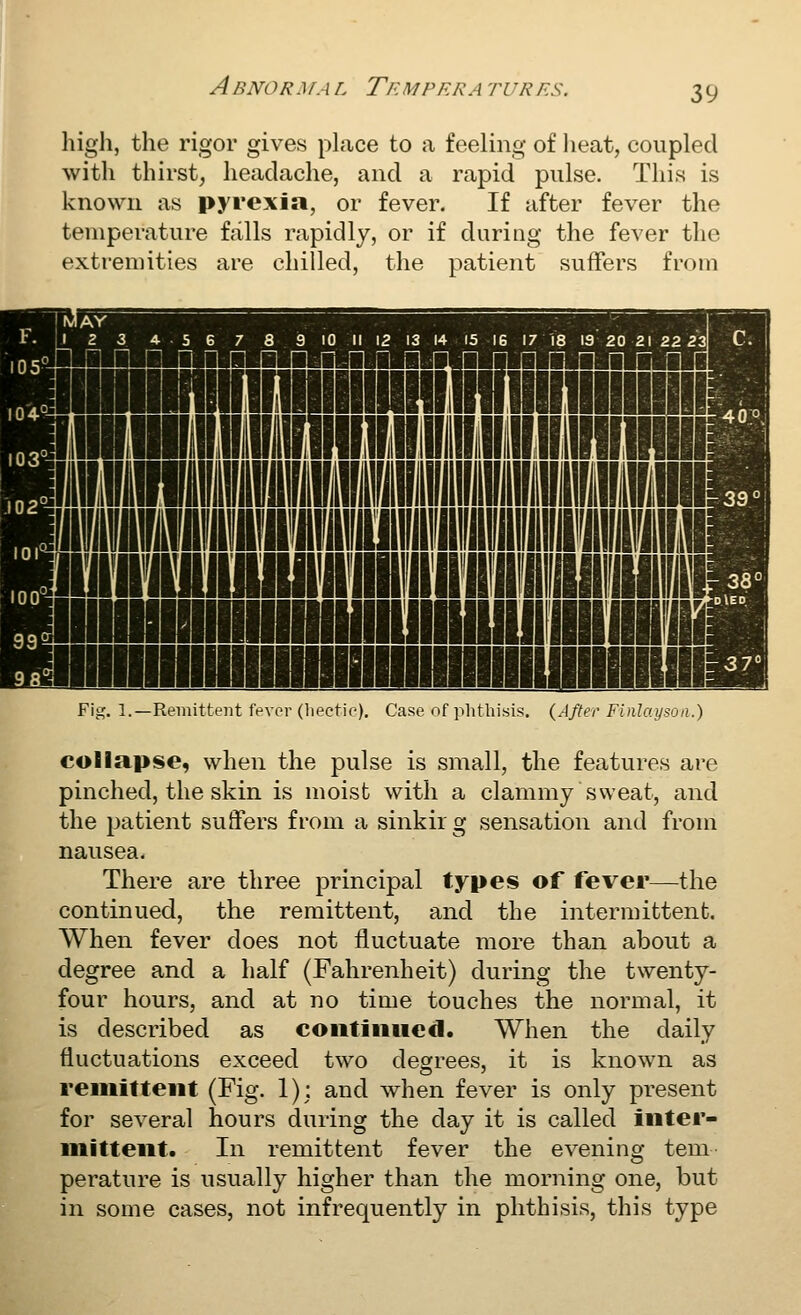 Abnormal Temperatures. high, the rigor gives place to a feeling of heat, coupled with thirst, headache, and a rapid pulse. This is known as pyrexia, or fever. If after fever the temperature falls rapidly, or if during the fever the extremities are chilled, the patient suffers from lUIIUUIIIIMII Fig. 1.—Remittent fever (hectie). Case of phthisis. (After Finlaysoa.) collapse, when the pulse is small, the features are pinched, the skin is moist with a clammy sweat, and the patient suffers from a sinkirg sensation and from nausea. There are three principal types of fever—the continued, the remittent, and the intermittent. When fever does not fluctuate more than about a degree and a half (Fahrenheit) during the twenty- four hours, and at no time touches the normal, it is described as coiitiiiHed. When the daily fluctuations exceed two degrees, it is known as remittent (Fig. 1): and when fever is only present for several hours during the day it is called inter- mittent. In remittent fever the evening tem perature is usually higher than the morning one, but in some cases, not infrequently in phthisis, this type