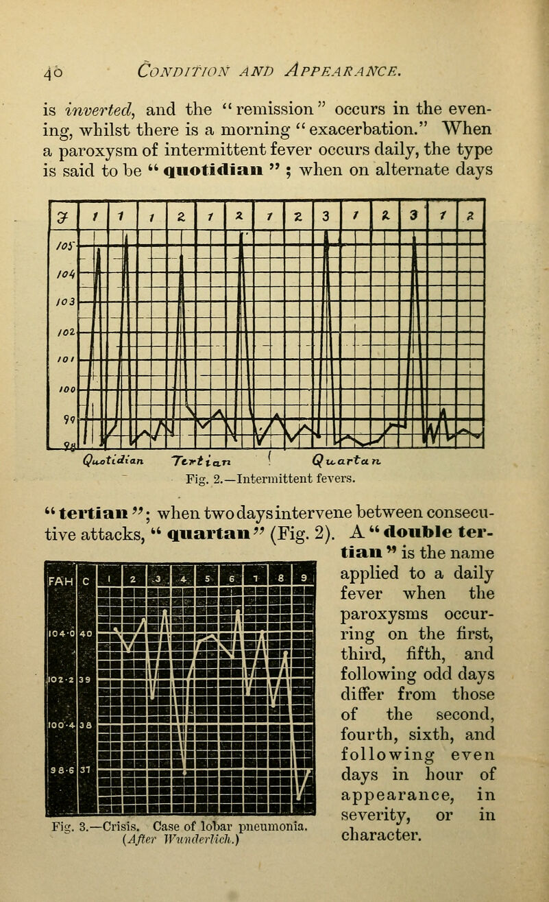 is inverted^ and the remission occurs in the even- ing, whilst there is a morning  exacerbation. When a paroxysm of intermittent fever occurs daily, the type is said to be  quotidiaii  ; when on alternate days ^ 1 1 1 Z 1 ^ 1 z 3 r a 9^ / 2 .... L»«, T- - T I- -3 It 4^ Jt lOli \ - -\ ,01 -. -- -^ 1 '{■■■■ 1 -\v - ..I5„^_._ A, ^ _1 , ^ J ^z^ d^^ \ y\ V i'^'sM ' Quotidian ^CT'tia.n : Qu,artun, Fig. 2.—Intermittent fevers.  tertian ^'; when two days intervene between consecu- tive attacks, *' quartan'^ (Fig. 2). A  double ter- tian  is the name applied to a daily fever when the .—JKBil „_^ ■S^iSaa ■■rjBSiii ■riigBBl IICi8i»BBI'aiW ■ ■■■■■IIBHH ■■■■■■■■ !■■ ■■■!!■■■ ■«■■■■ ■■ ■■■■■■(■■■■■■■■■lar ■■■■■■■ Fig. 3.—Crisis. Case of lobar pneumonia. {After Wiimlerlicli.) paroxysms occur- ring on the first, third, fifth, and following odd days differ from those of the second, fourth, sixth, and following even days in hour of appearance, in severity, or in character.
