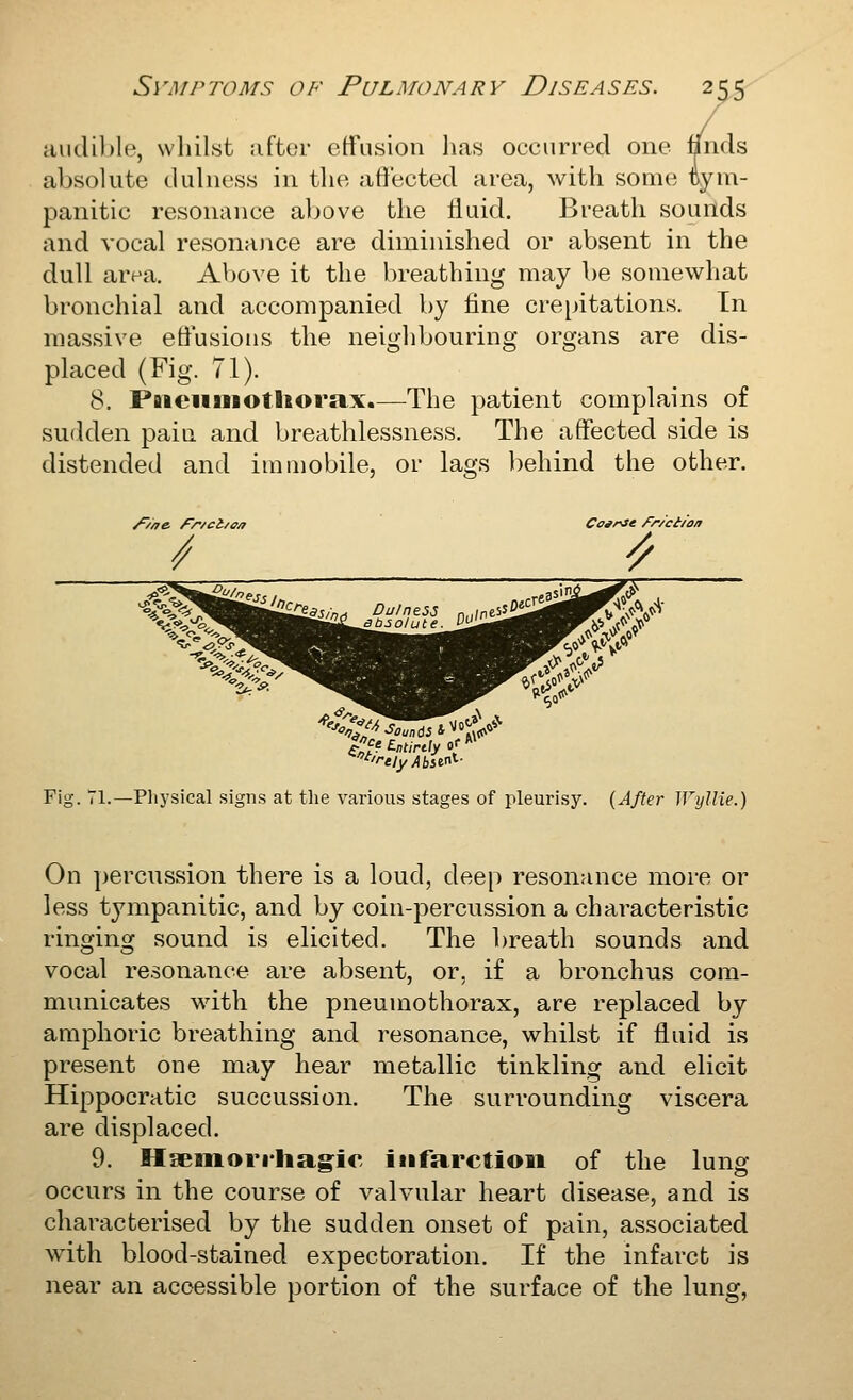 aiidil)le, whilst ;iftor etfusion lias occurred one nnds absolute dulness in the affected area, with some tym- panitic resonance above the fluid. Breath sounds and vocal resonajice are diminished or absent in the dull area. Above it the breathing may be somewhat bronchial and accompanied by fine crepitations. En massive effusions the neighbouring organs are dis- placed (Fig. 71). 8. Paieuiiiotliorax.—The patient complains of sudden pain and breathlessness. The affected side is distended and immobile, or lags behind the other. ///7e /^r/ct/o/i Coarse /^r/'ct/im Fig. 71.—Physical signs at the various stages of pleurisy. (After Wyllie.) On ])ercussion there is a loud, deep resonance more or less tympanitic, and by coin-percussion a characteristic ringing sound is elicited. The breath sounds and vocal resonance are absent, or, if a bronchus com- municates with the pneumothorax, are replaced by amphoric breathing and resonance, whilst if fluid is present one may hear metallic tinkling and elicit Hippocratic succussion. The surrounding viscera are displaced. 9. Haeniorrliagic infarction of the lung occurs in the course of valvular heart disease, and is characterised by the sudden onset of pain, associated with blood-stained expectoration. If the infarct is near an accessible portion of the surface of the lung,