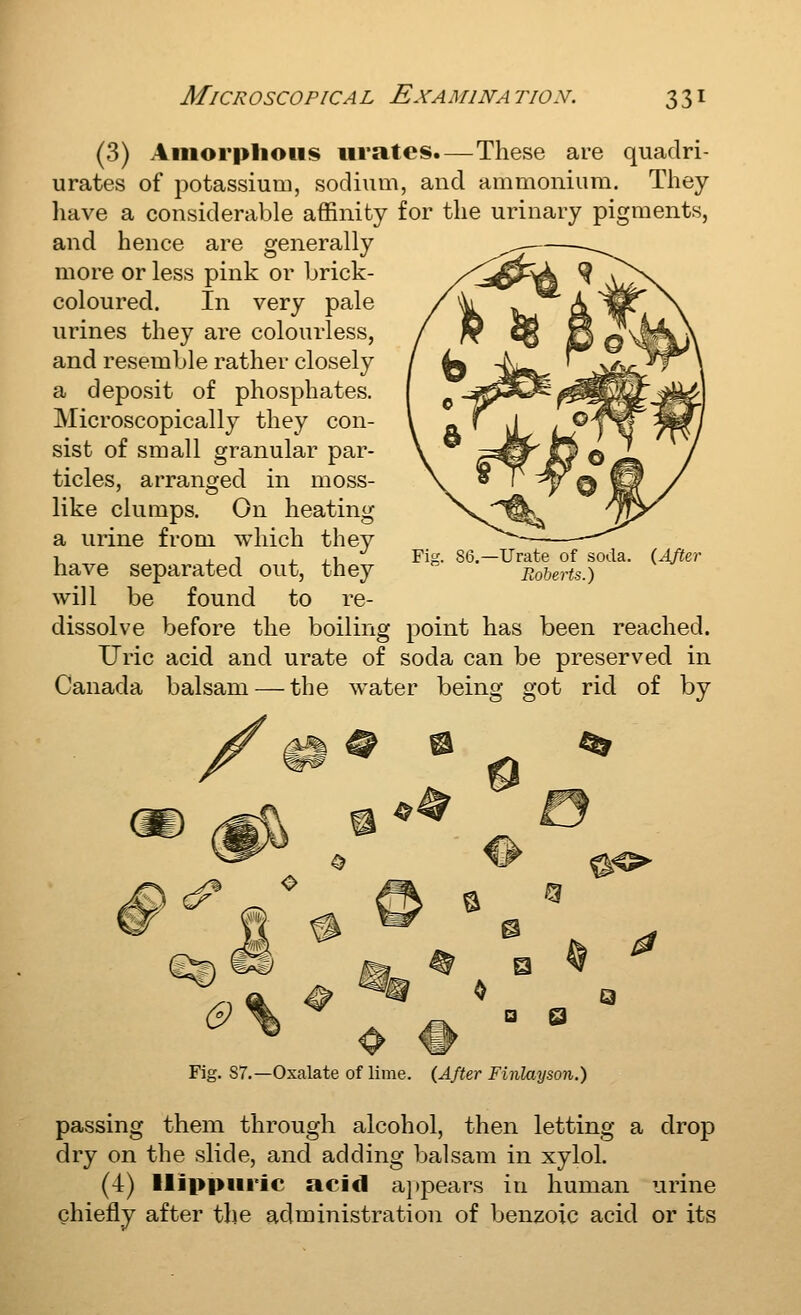 (3) Amorphous urates.—These are quadri- urates of potassium, sodium, and ammonium. Tliey have a considerable affinity for the urinary pigments, and hence are generally more or less pink or brick- coloured. In very pale urines they are colourless, and resemble rather closely a deposit of phosphates. Microscopically they con- sist of small granular par- ticles, arranged in moss- like clumps. On heating a urine from which they have separated out, they will be found to re- dissolve before the boiling point has been reached. Uric acid and urate of soda can be preserved in Canada balsam — the water being got rid of by Fig. 86.—Urate of soda. {AfUr Roberts.) Fig. 87.—Oxalate of lime. (After Finlayson.) drop passing them through alcohol, then letting a dry on the slide, and adding balsam in xyloL (4) llippiiric acid a|)pears in human urine ghiefly after the administration of benzoic acid or its